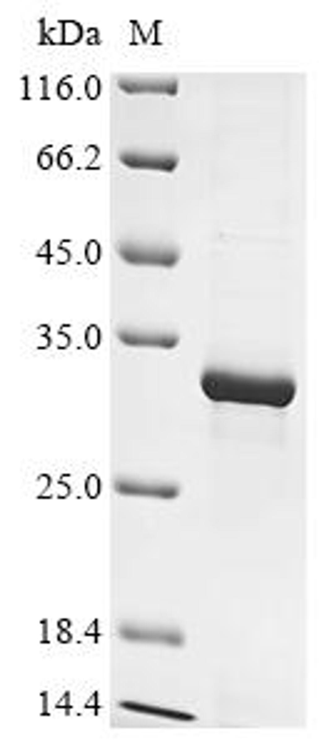 (Tris-Glycine gel) Discontinuous SDS-PAGE (reduced) with 5% enrichment gel and 15% separation gel.