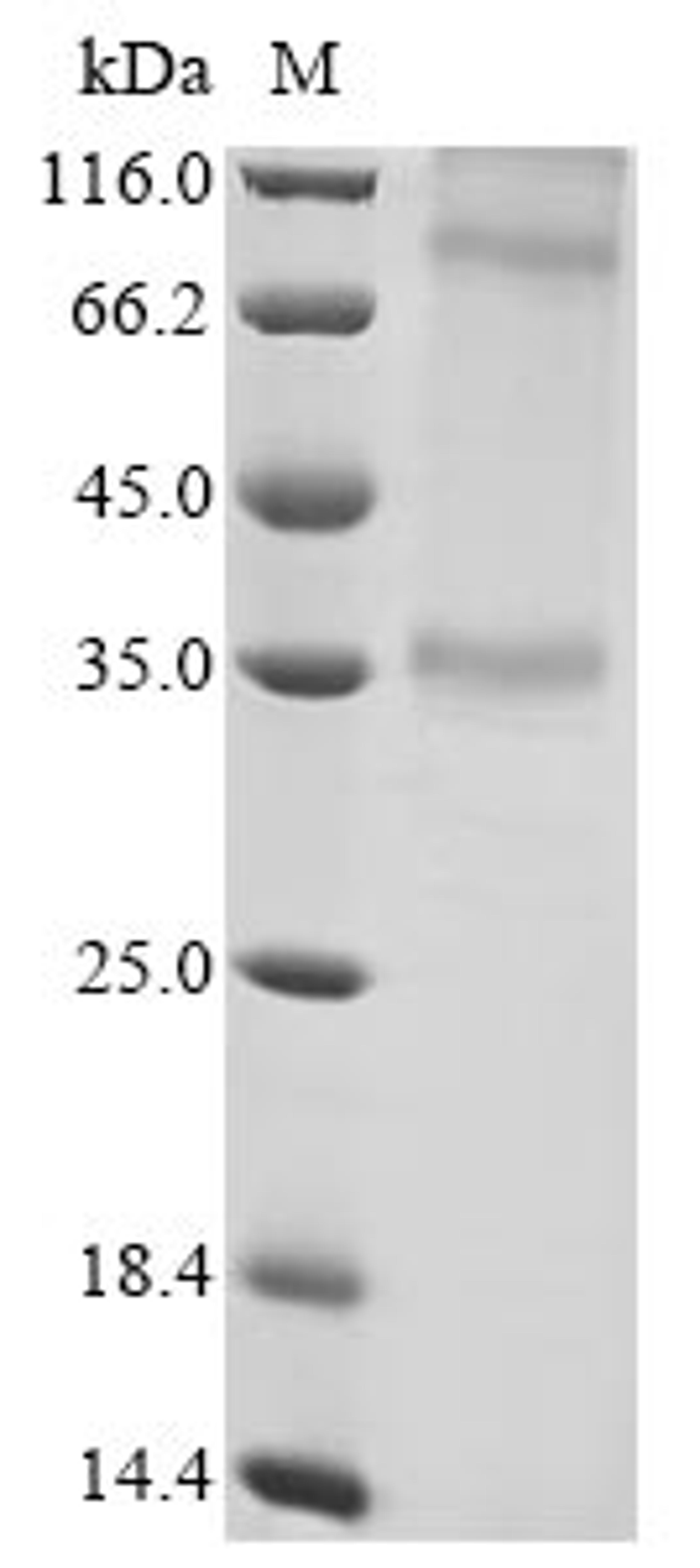 (Tris-Glycine gel) Discontinuous SDS-PAGE (reduced) with 5% enrichment gel and 15% separation gel.