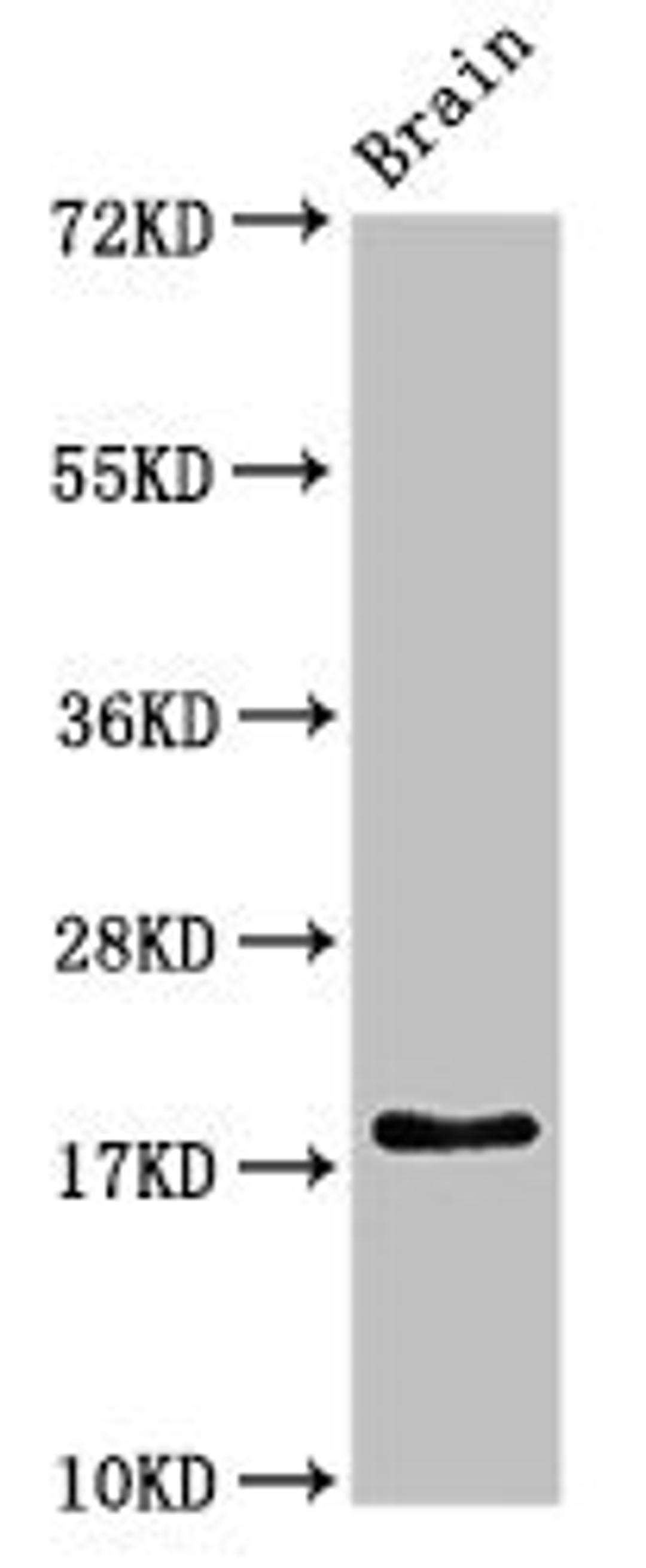 Western Blot. Positive WB detected in: Rat brain tissue. All lanes: RPL23A antibody at 3ug/ml. Secondary. Goat polyclonal to rabbit IgG at 1/50000 dilution. Predicted band size: 18 kDa. Observed band size: 18 kDa.