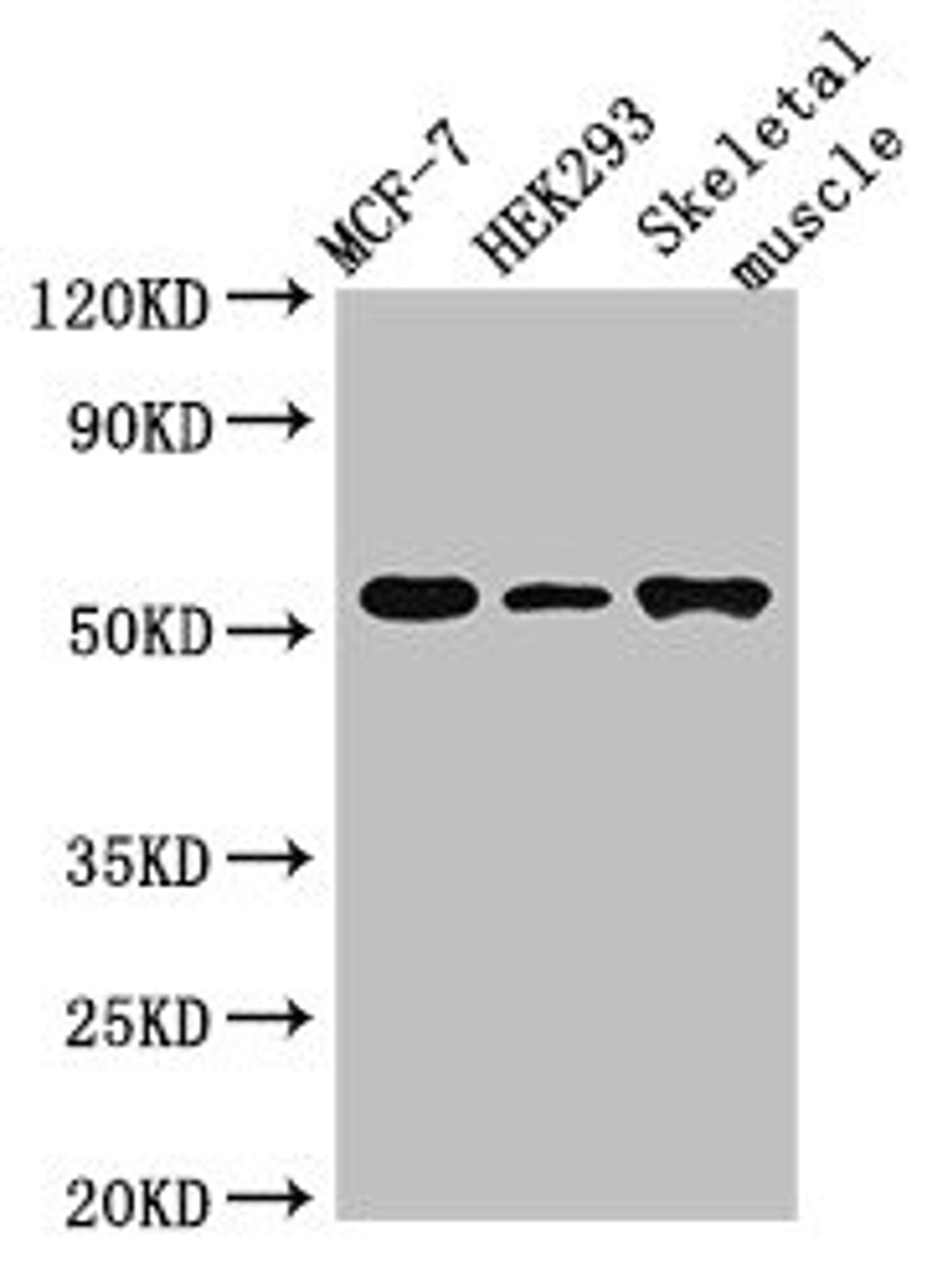 Western Blot. Positive WB detected in: MCF-7 whole cell lysate, HEK293 whole cell lysate, Mouse skeletal muscle tissue. All lanes: RMND1 antibody at 3µg/ml. Secondary. Goat polyclonal to rabbit IgG at 1/50000 dilution. Predicted band size: 52, 28, 24 kDa. Observed band size: 52 kDa