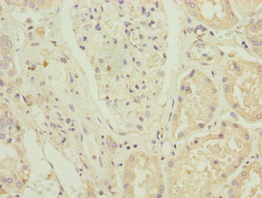 Immunohistochemistry of paraffin-embedded human kidney tissue using CSB-PA026876LA01HU at dilution of 1:100