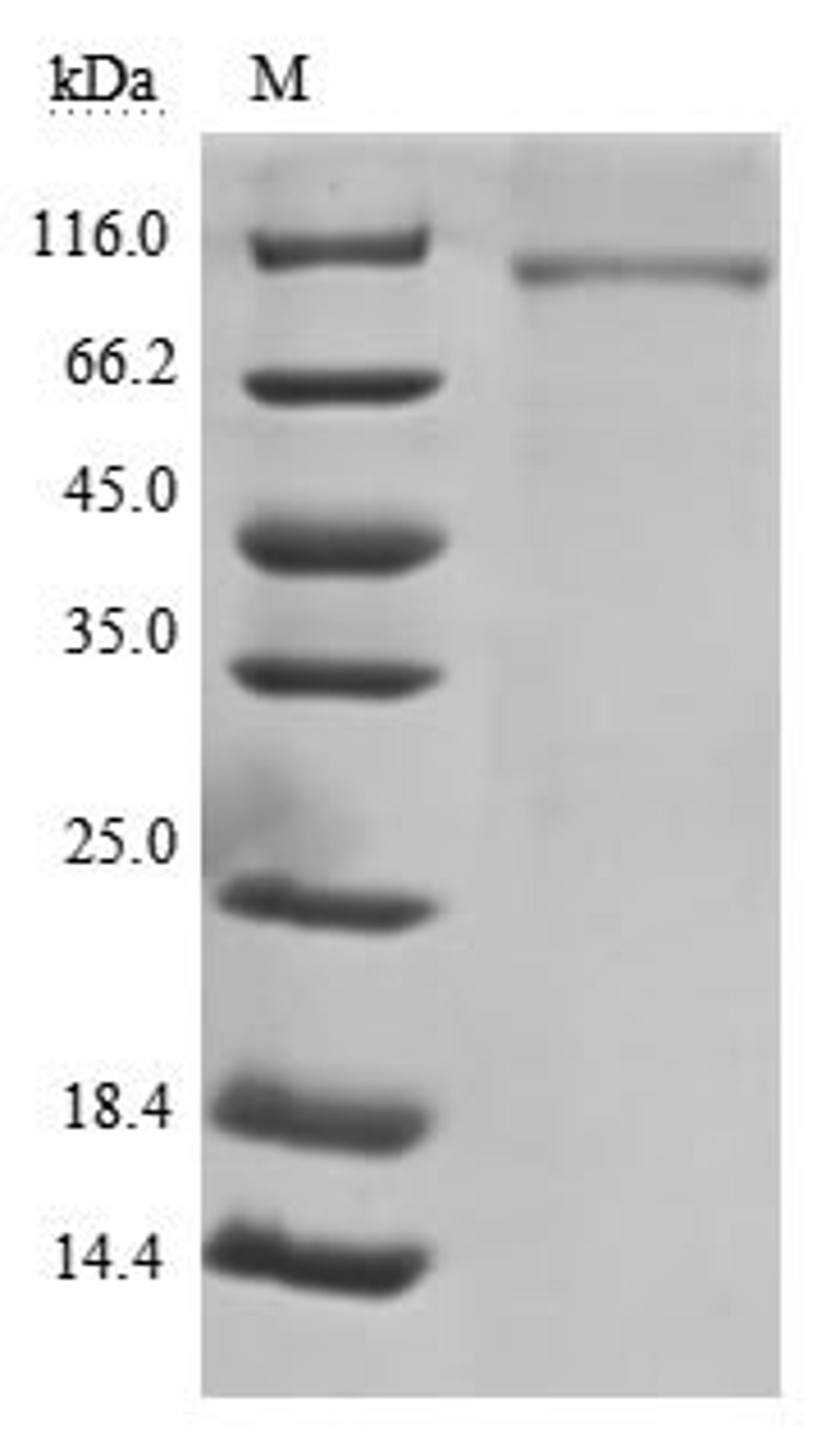 (Tris-Glycine gel) Discontinuous SDS-PAGE (reduced) with 5% enrichment gel and 15% separation gel.