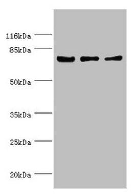 Western blot. All lanes: KLC1 antibody at 1.34µg/ml. Lane 1: Colo320 whole cell lysate. Lane 2: HepG2 whole cell lysate. Lane 3: SH-SY5Y whole cell lysate. Secondary. Goat polyclonal to rabbit IgG at 1/10000 dilution. Predicted band size: 66, 64, 65, 72, 70, 67, 63, 73 kDa. Observed band size: 72 kDa
