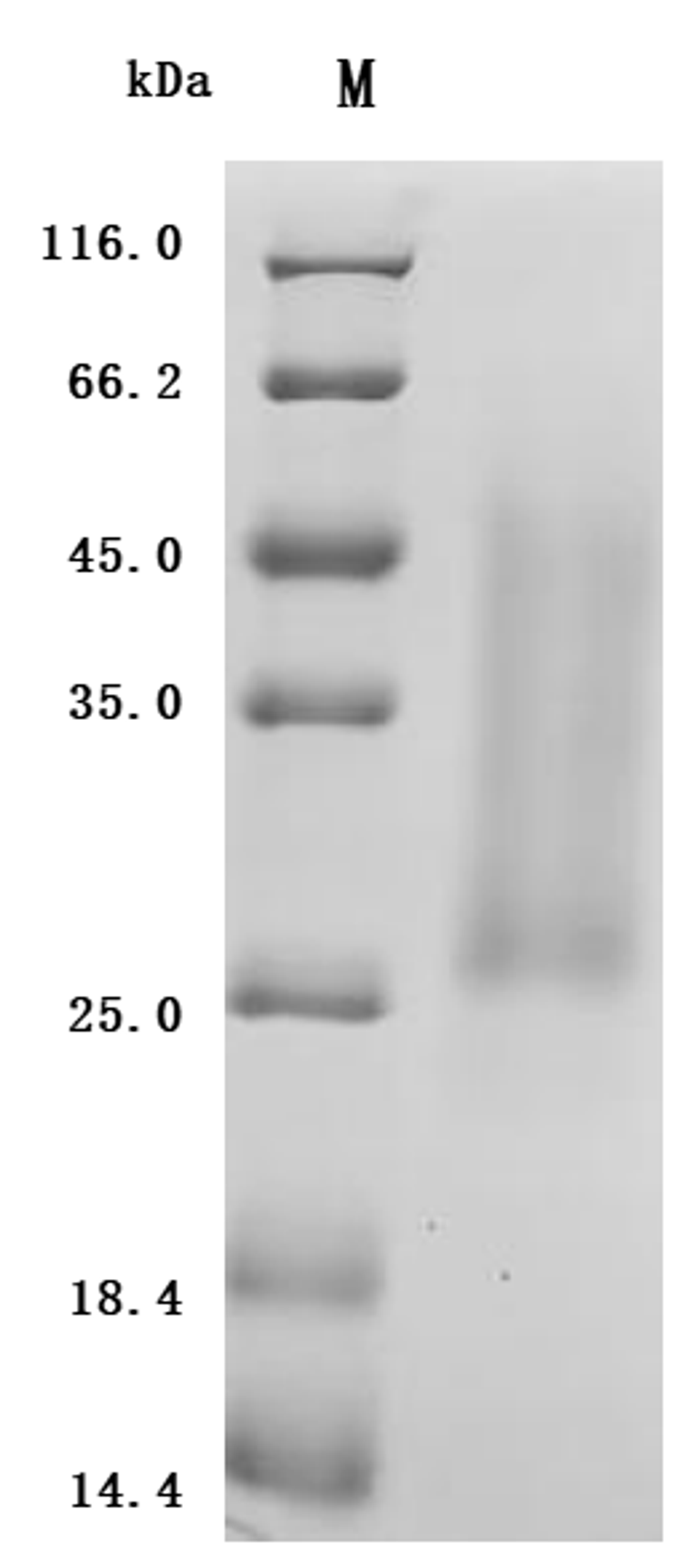 (Tris-Glycine gel) Discontinuous SDS-PAGE (reduced) with 5% enrichment gel and 15% separation gel.