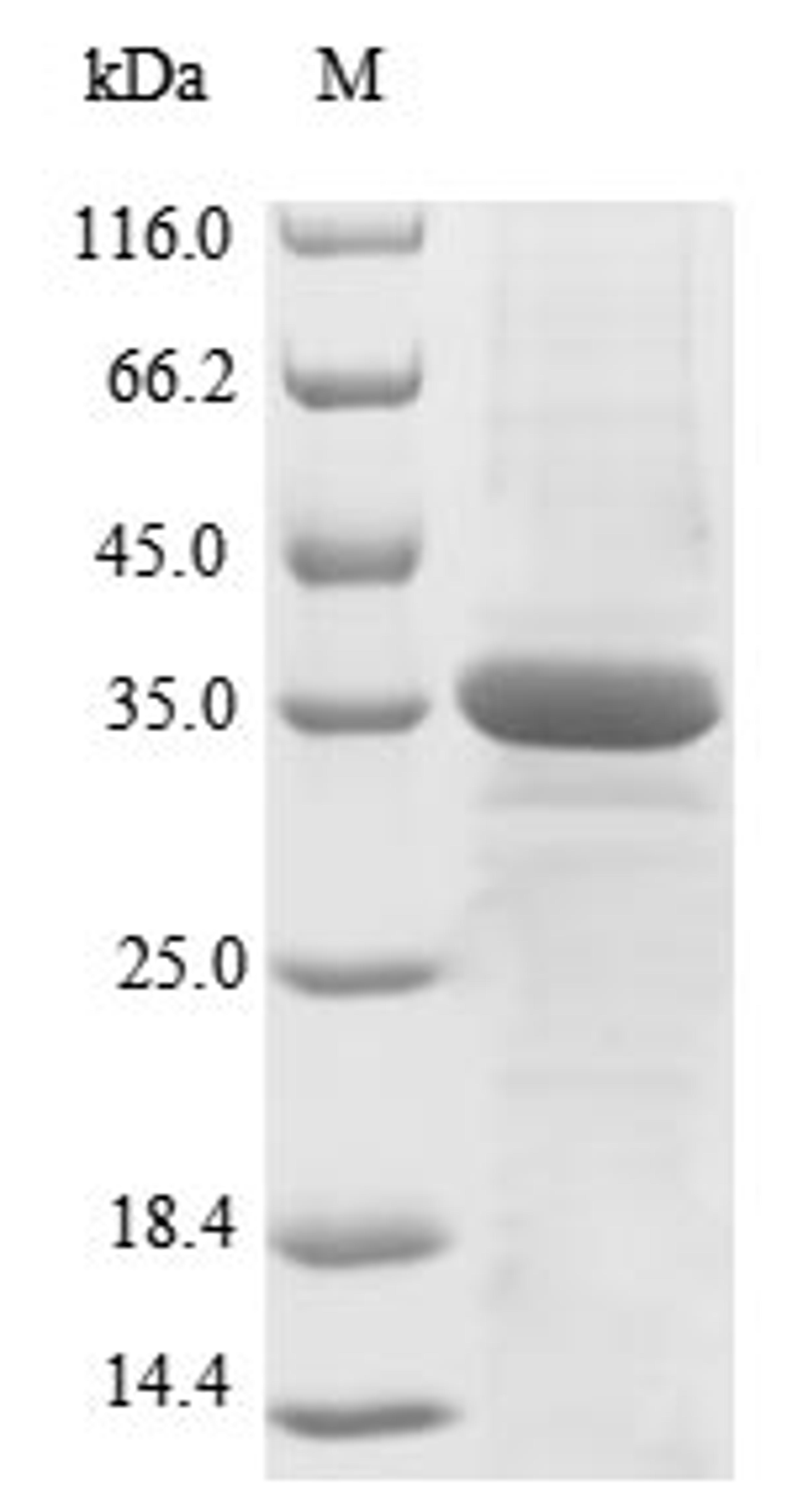 (Tris-Glycine gel) Discontinuous SDS-PAGE (reduced) with 5% enrichment gel and 15% separation gel.