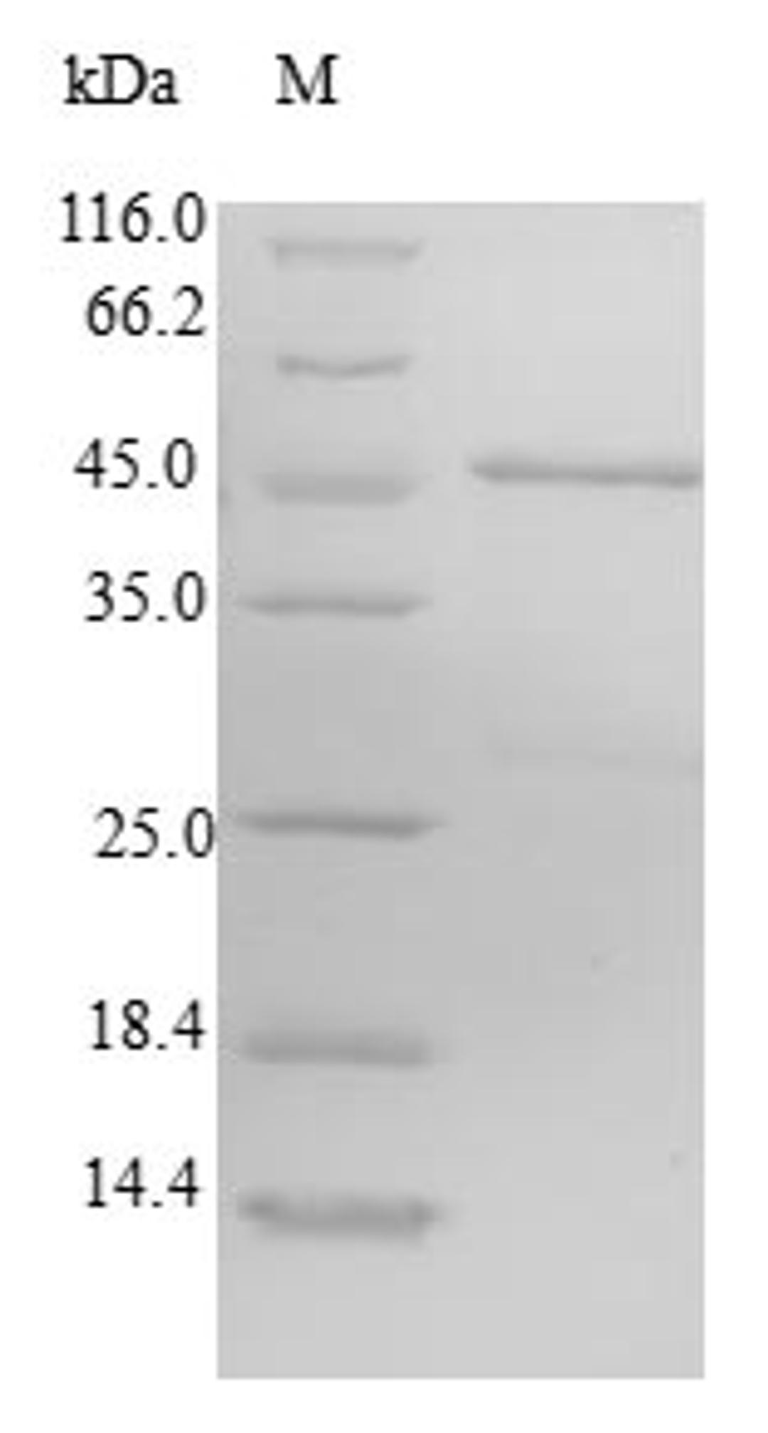 (Tris-Glycine gel) Discontinuous SDS-PAGE (reduced) with 5% enrichment gel and 15% separation gel.