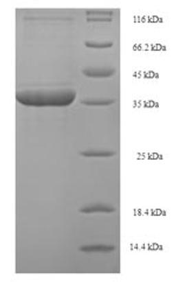 (Tris-Glycine gel) Discontinuous SDS-PAGE (reduced) with 5% enrichment gel and 15% separation gel.