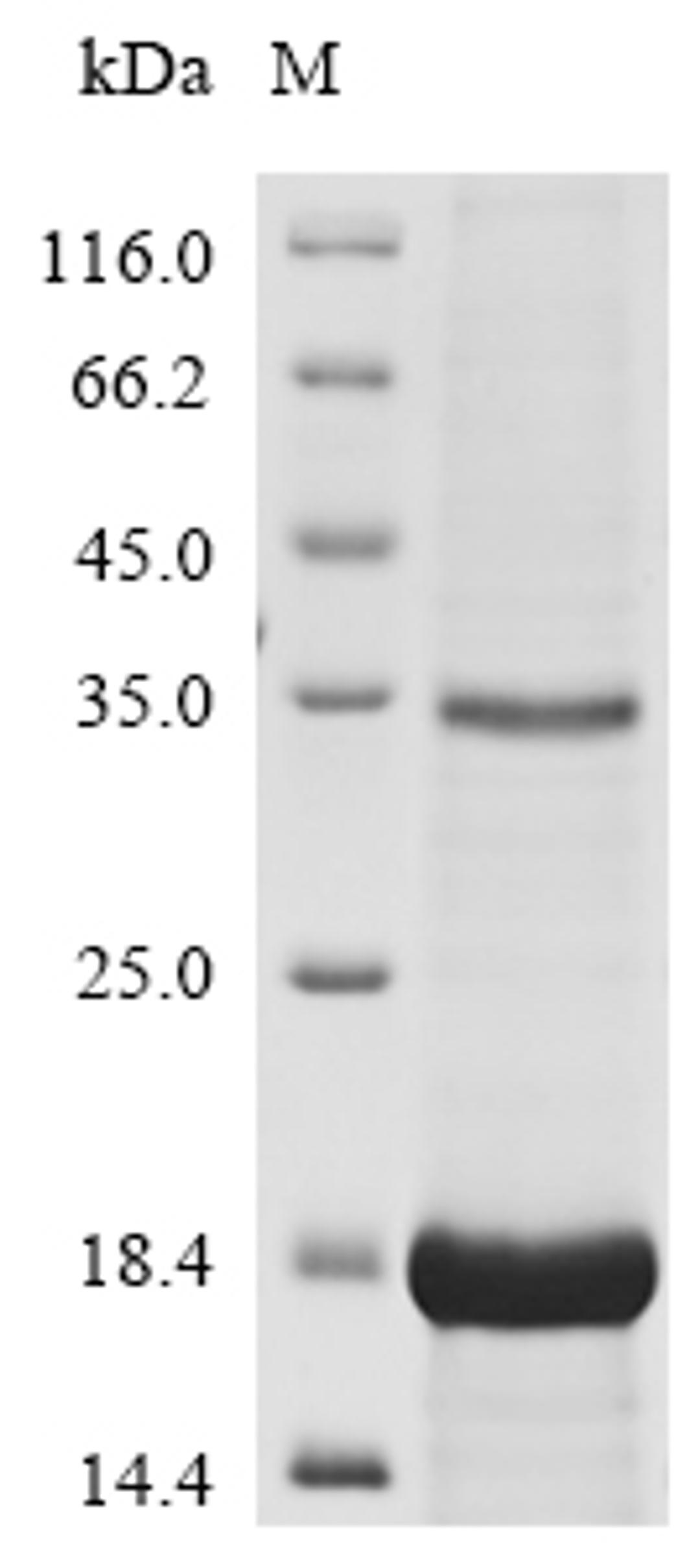 (Tris-Glycine gel) Discontinuous SDS-PAGE (reduced) with 5% enrichment gel and 15% separation gel.