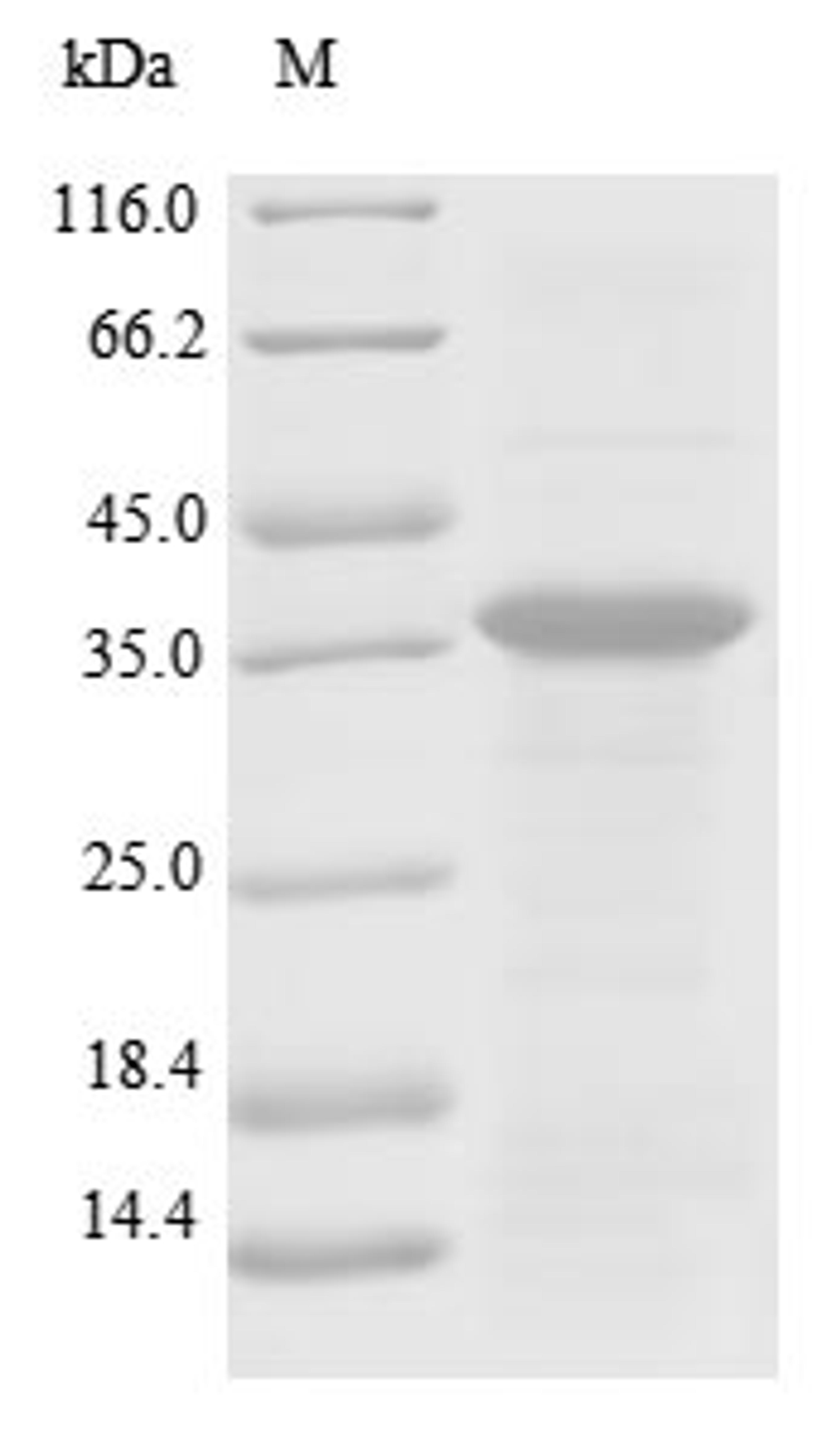(Tris-Glycine gel) Discontinuous SDS-PAGE (reduced) with 5% enrichment gel and 15% separation gel.