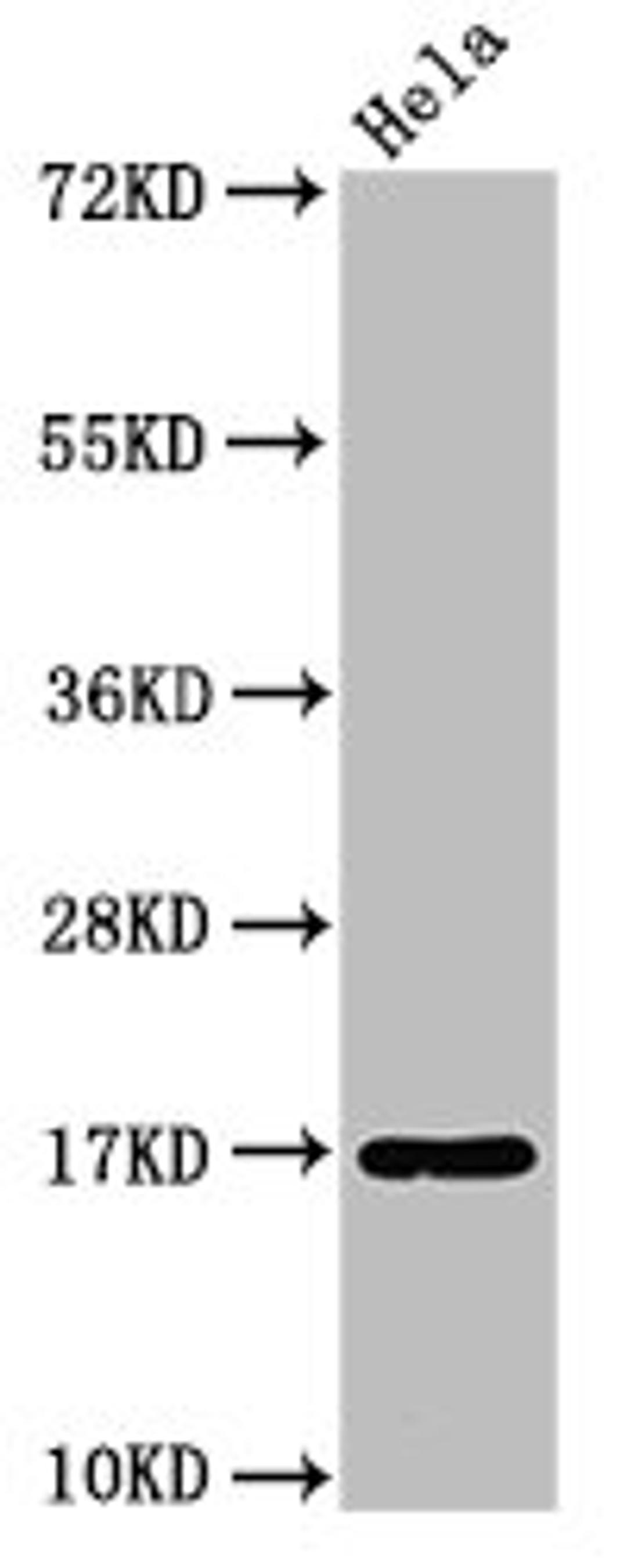 Western Blot. Positive WB detected in: Hela whole cell lysate. All lanes: C1D antibody at 3.2µg/ml. Secondary. Goat polyclonal to rabbit IgG at 1/50000 dilution. Predicted band size: 17 kDa. Observed band size: 17 kDa