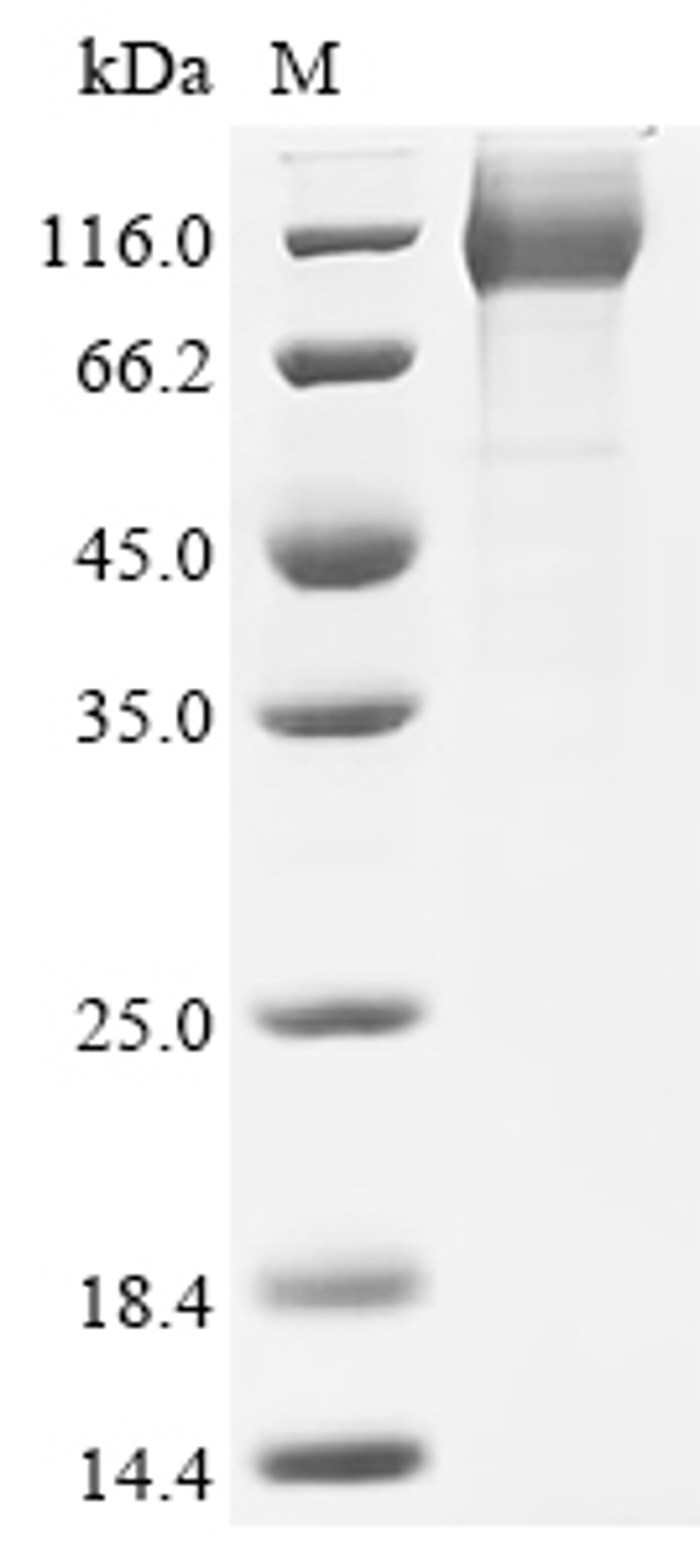 (Tris-Glycine gel) Discontinuous SDS-PAGE (reduced) with 5% enrichment gel and 15% separation gel.