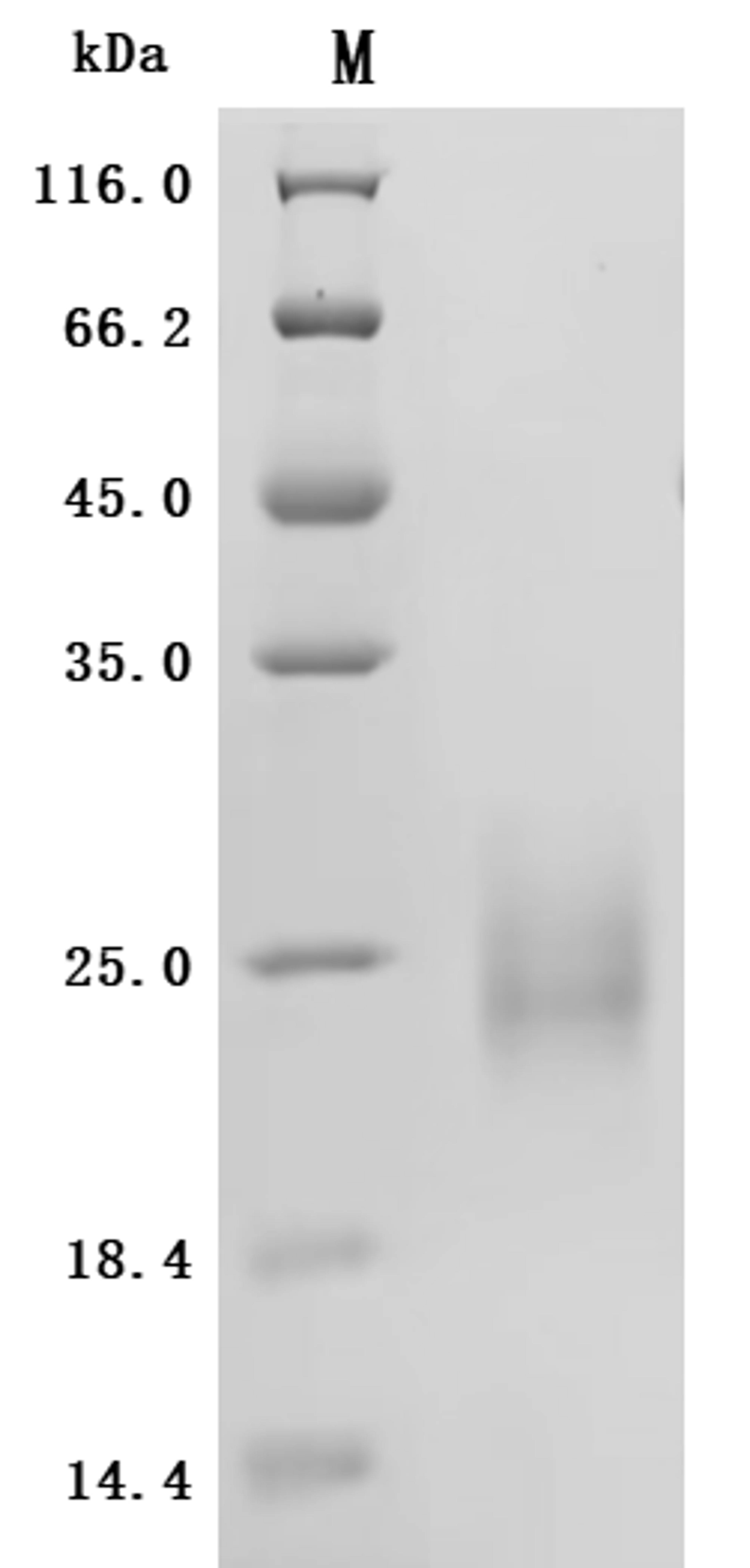 (Tris-Glycine gel) Discontinuous SDS-PAGE (reduced) with 5% enrichment gel and 15% separation gel.