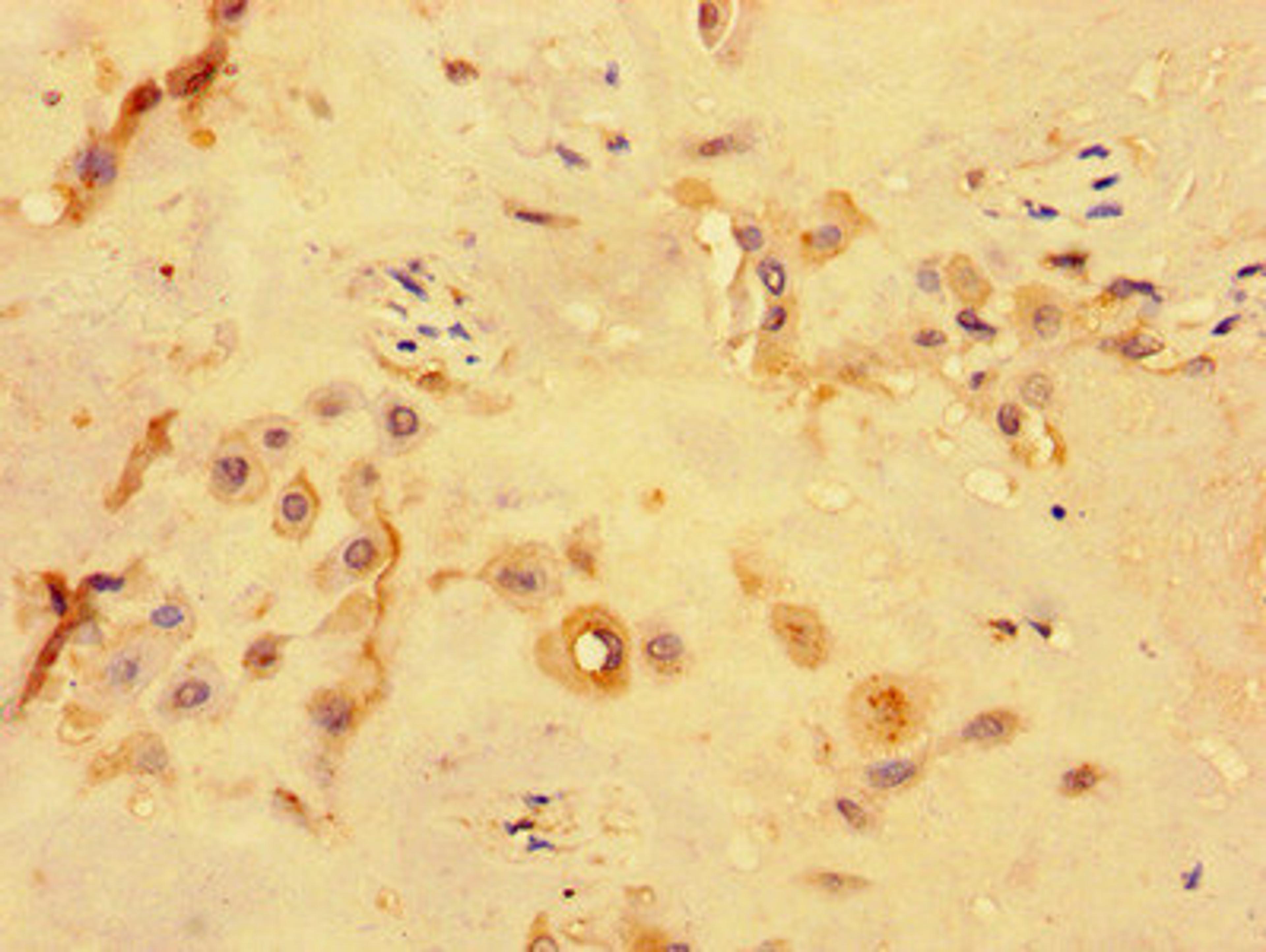 Immunohistochemistry of paraffin-embedded human placenta tissue using CSB-PA767197LA01HU at dilution of 1:100