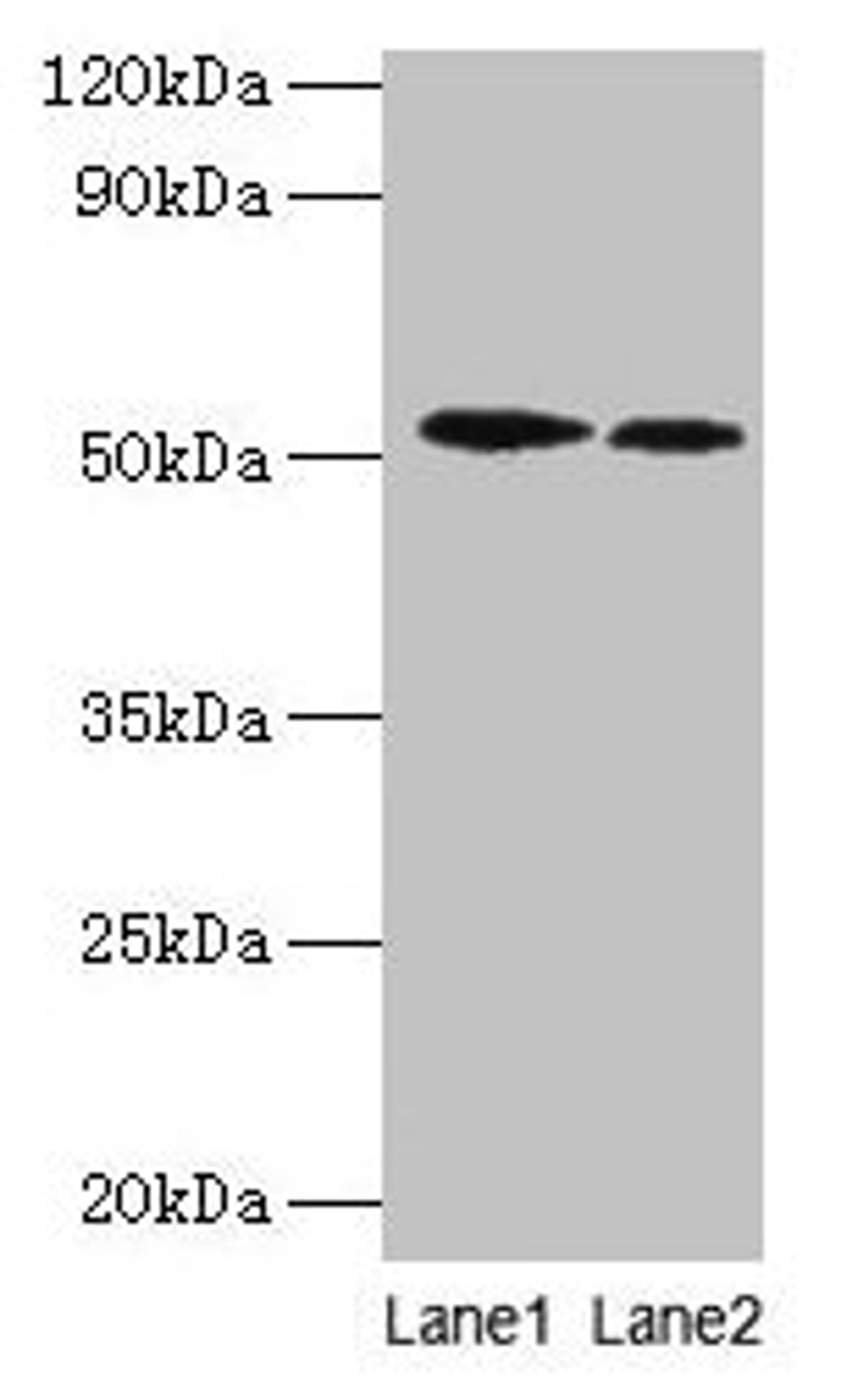 Western blot. All lanes: RPS6KB2 antibody at 2µg/ml. Lane 1: EC109 whole cell lysate. Lane 2: 293T whole cell lysate. Secondary. Goat polyclonal to rabbit IgG at 1/15000 dilution. Predicted band size: 54, 17 kDa. Observed band size: 54 kDa