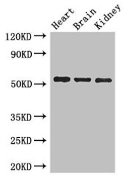 Western Blot. Positive WB detected in: Mouse heart tissue, Mouse brain tissue, Mouse kidney tissue. All lanes: SH3BP5 antibody at 3ug/ml. Secondary. Goat polyclonal to rabbit IgG at 1/50000 dilution. Predicted band size: 51, 33 kDa. Observed band size: 51 kDa.