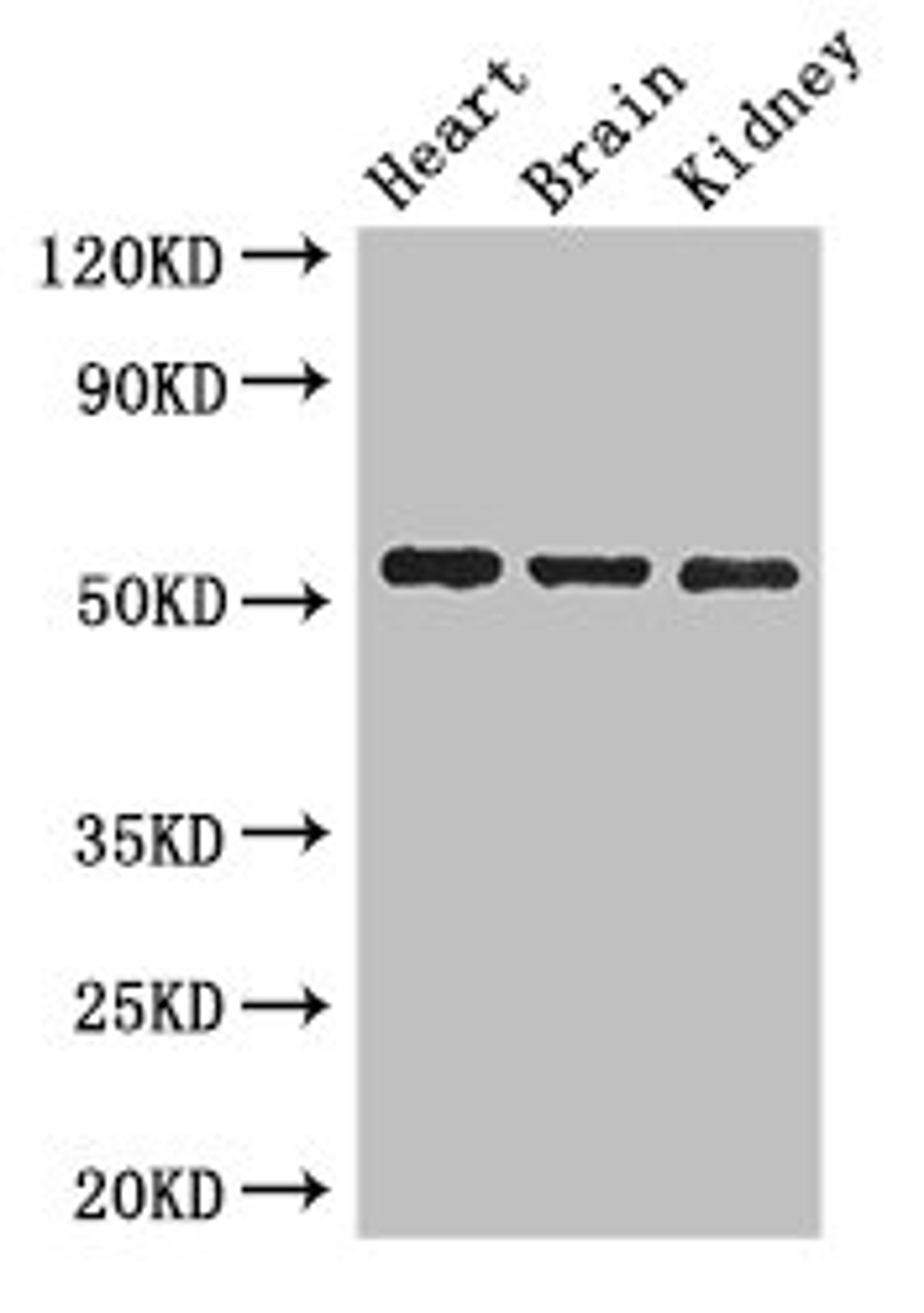 Western Blot. Positive WB detected in: Mouse heart tissue, Mouse brain tissue, Mouse kidney tissue. All lanes: SH3BP5 antibody at 3ug/ml. Secondary. Goat polyclonal to rabbit IgG at 1/50000 dilution. Predicted band size: 51, 33 kDa. Observed band size: 51 kDa.