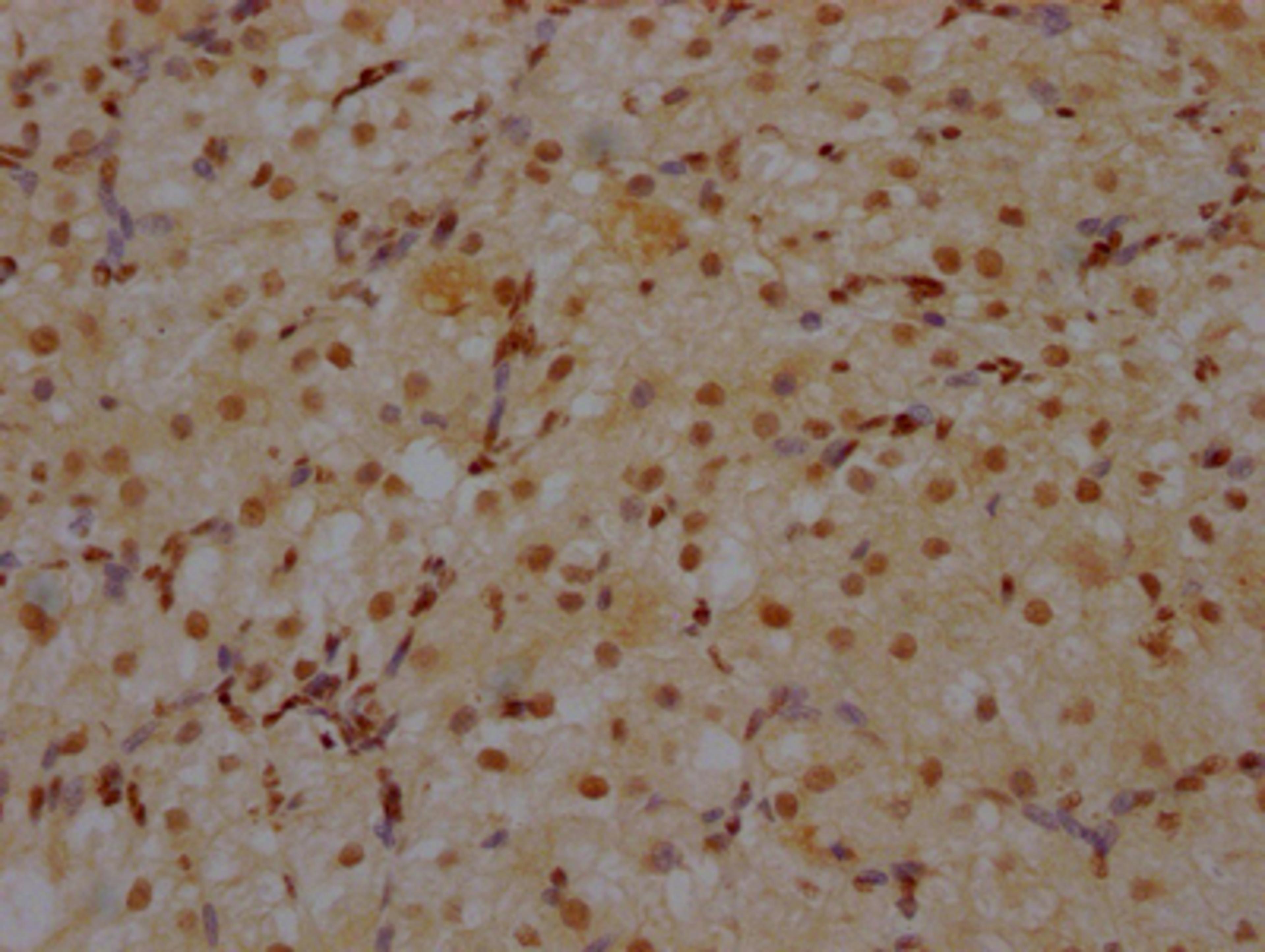 IHC image of CSB-RA930964A0HU diluted at 1:100 and staining in paraffin-embedded human ovarian tissue performed on a Leica BondTM system. After dewaxing and hydration, antigen retrieval was mediated by high pressure in a citrate buffer (pH 6.0). Section was blocked with 10% normal goat serum 30min at RT. Then primary antibody (1% BSA) was incubated at 4℃ overnight. The primary is detected by a Goat anti-rabbit IgG polymer labeled by HRP and visualized using 0.05% DAB.