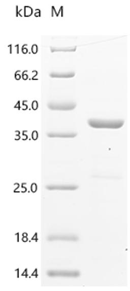 (Tris-Glycine gel) Discontinuous SDS-PAGE (reduced) with 5% enrichment gel and 15% separation gel.