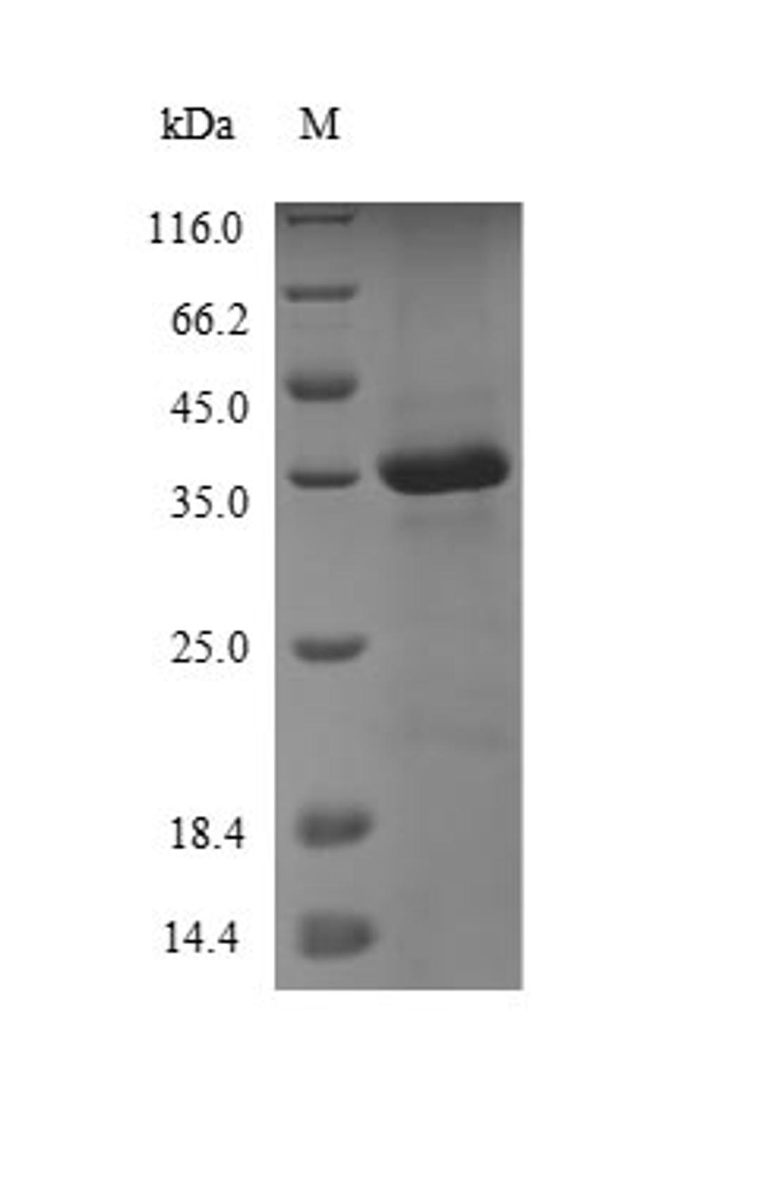 (Tris-Glycine gel) Discontinuous SDS-PAGE (reduced) with 5% enrichment gel and 15% separation gel.