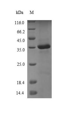(Tris-Glycine gel) Discontinuous SDS-PAGE (reduced) with 5% enrichment gel and 15% separation gel.