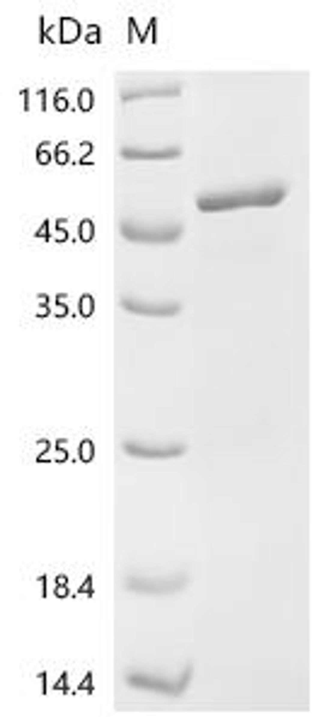(Tris-Glycine gel) Discontinuous SDS-PAGE (reduced) with 5% enrichment gel and 15% separation gel.