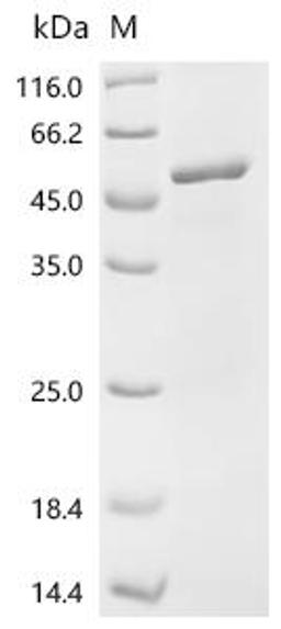 (Tris-Glycine gel) Discontinuous SDS-PAGE (reduced) with 5% enrichment gel and 15% separation gel.