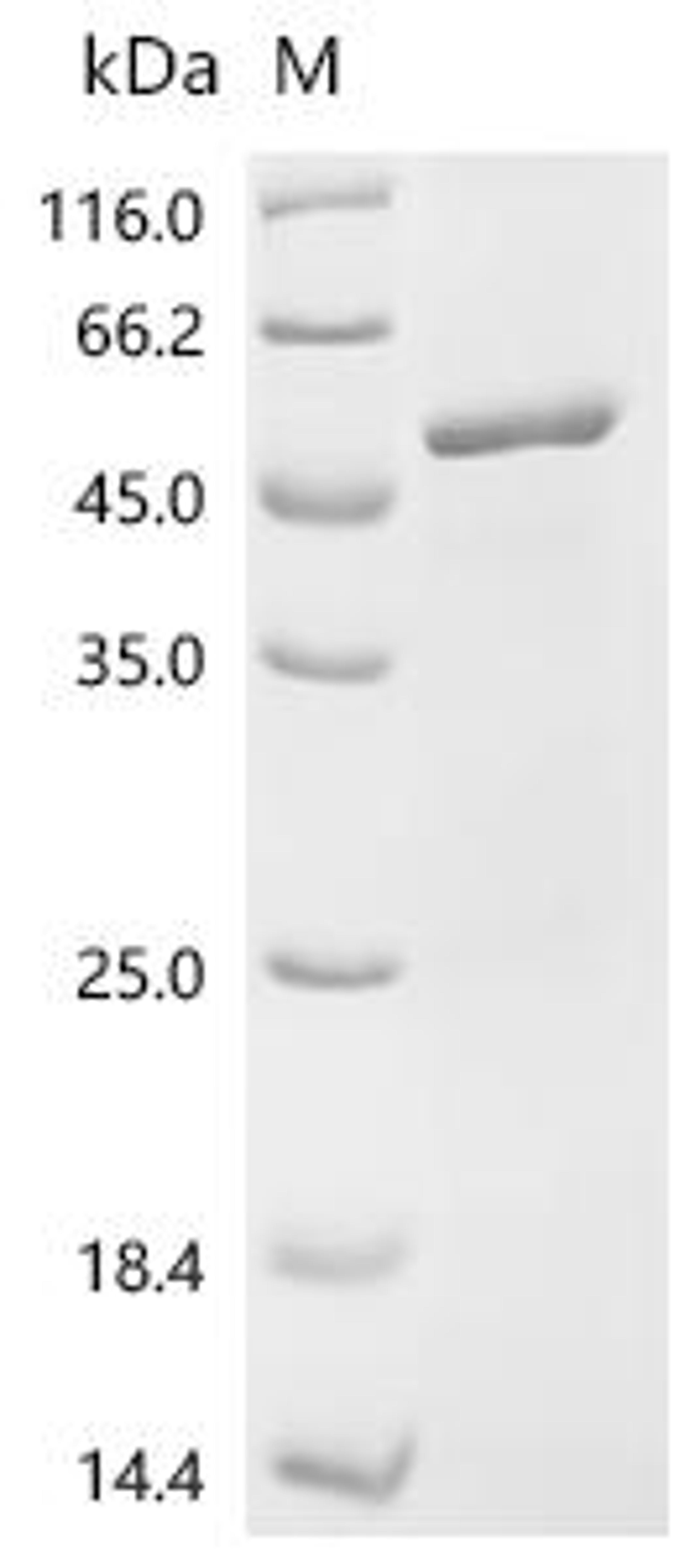 (Tris-Glycine gel) Discontinuous SDS-PAGE (reduced) with 5% enrichment gel and 15% separation gel.