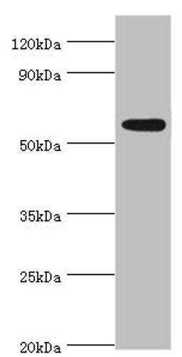 Western blot. All lanes: Poly [ADP-ribose] polymerase 3 antibody at 2ug/ml + Mouse heart tissue. Secondary. Goat polyclonal to rabbit IgG at 1/10000 dilution. Predicted band size: 60 kDa. Observed band size: 60 kDa. 