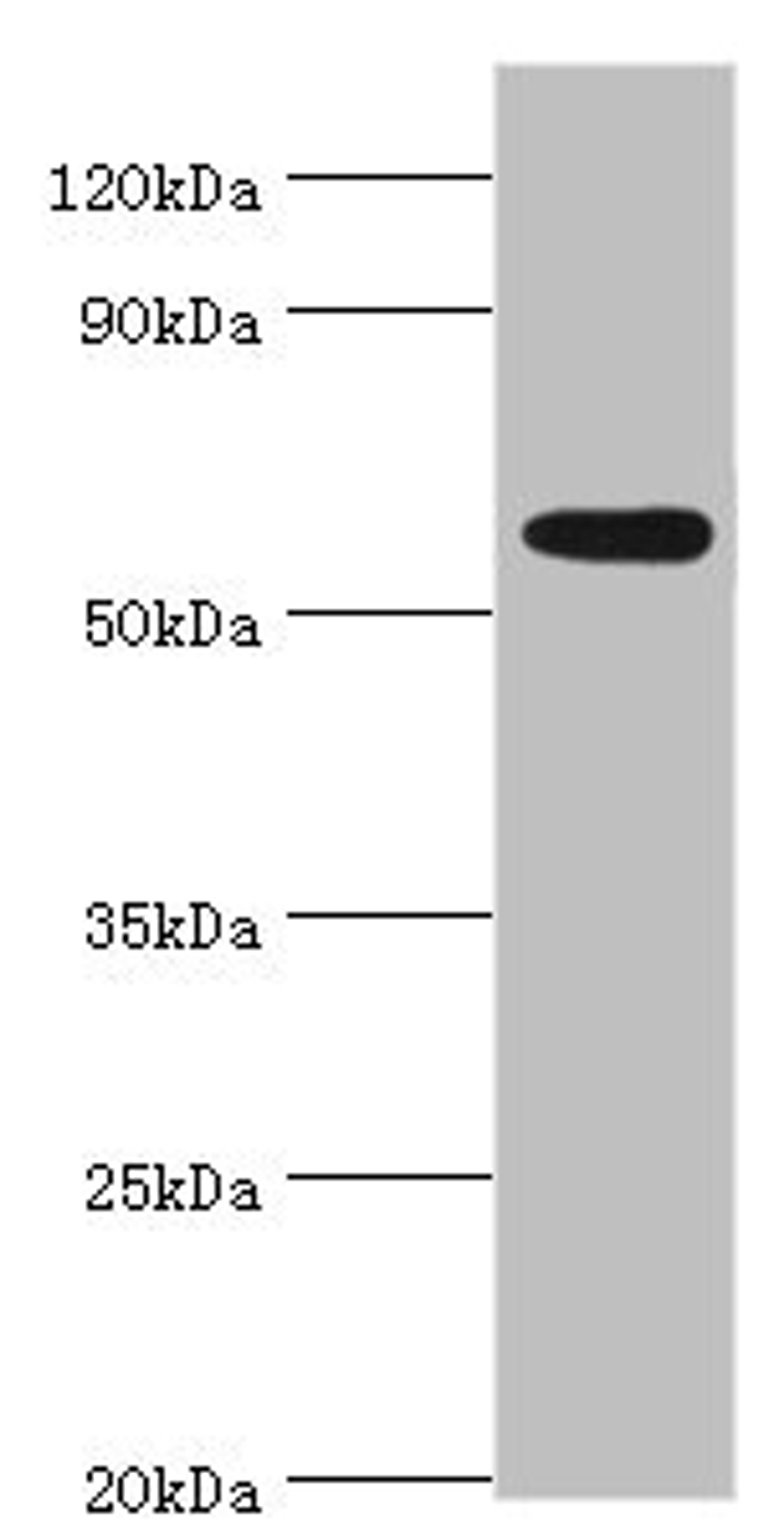 Western blot. All lanes: Poly [ADP-ribose] polymerase 3 antibody at 2ug/ml + Mouse heart tissue. Secondary. Goat polyclonal to rabbit IgG at 1/10000 dilution. Predicted band size: 60 kDa. Observed band size: 60 kDa. 