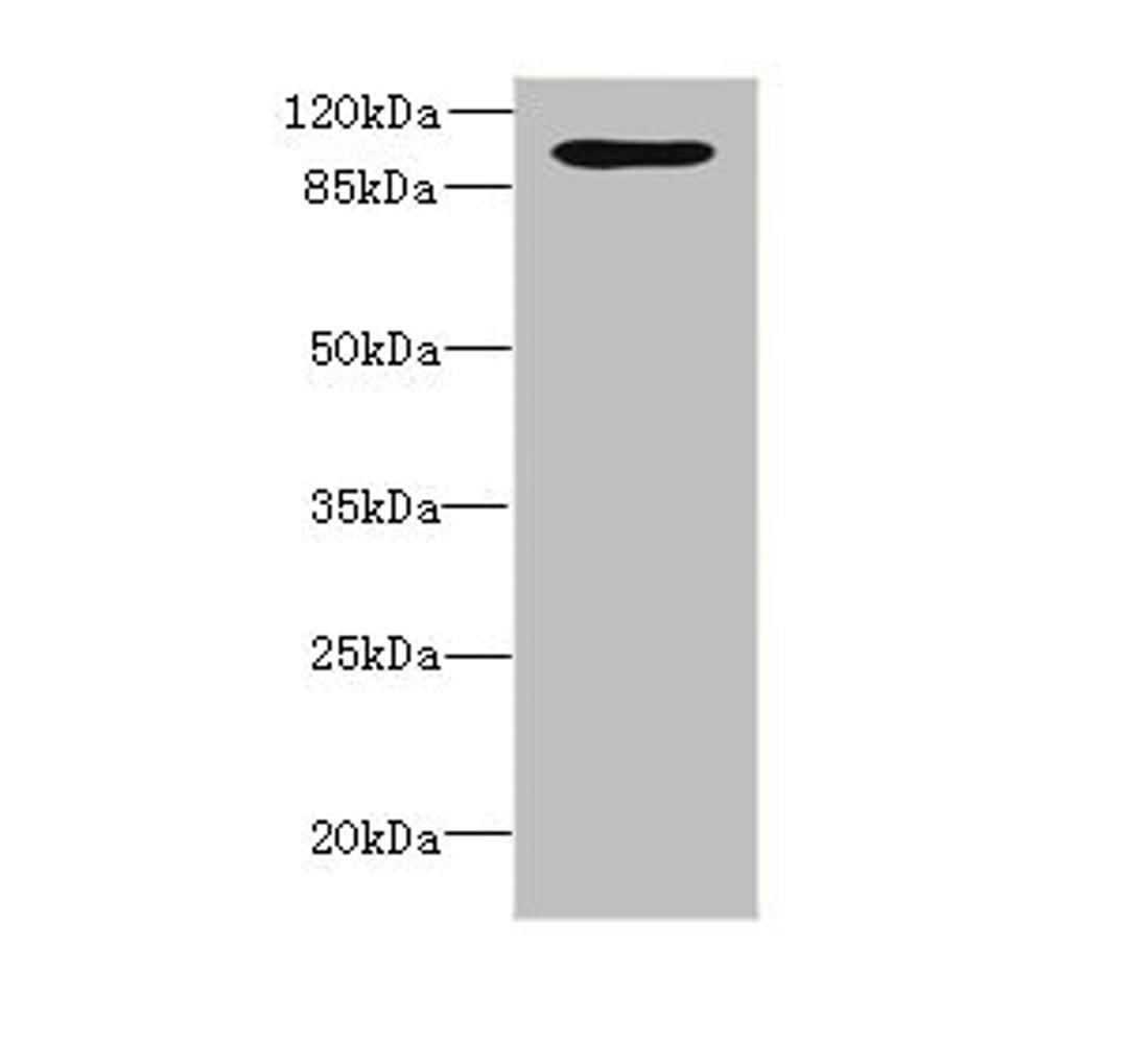 Western blot. All lanes: OPHN1 antibody at 1.87ug/ml + A549 whole cell lysate. Secondary. Goat polyclonal to rabbit IgG at 1/10000 dilution. Predicted band size: 92, 37 kDa. Observed band size: 92 kDa. 