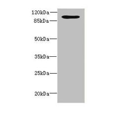 Western blot. All lanes: OPHN1 antibody at 1.87ug/ml + A549 whole cell lysate. Secondary. Goat polyclonal to rabbit IgG at 1/10000 dilution. Predicted band size: 92, 37 kDa. Observed band size: 92 kDa. 