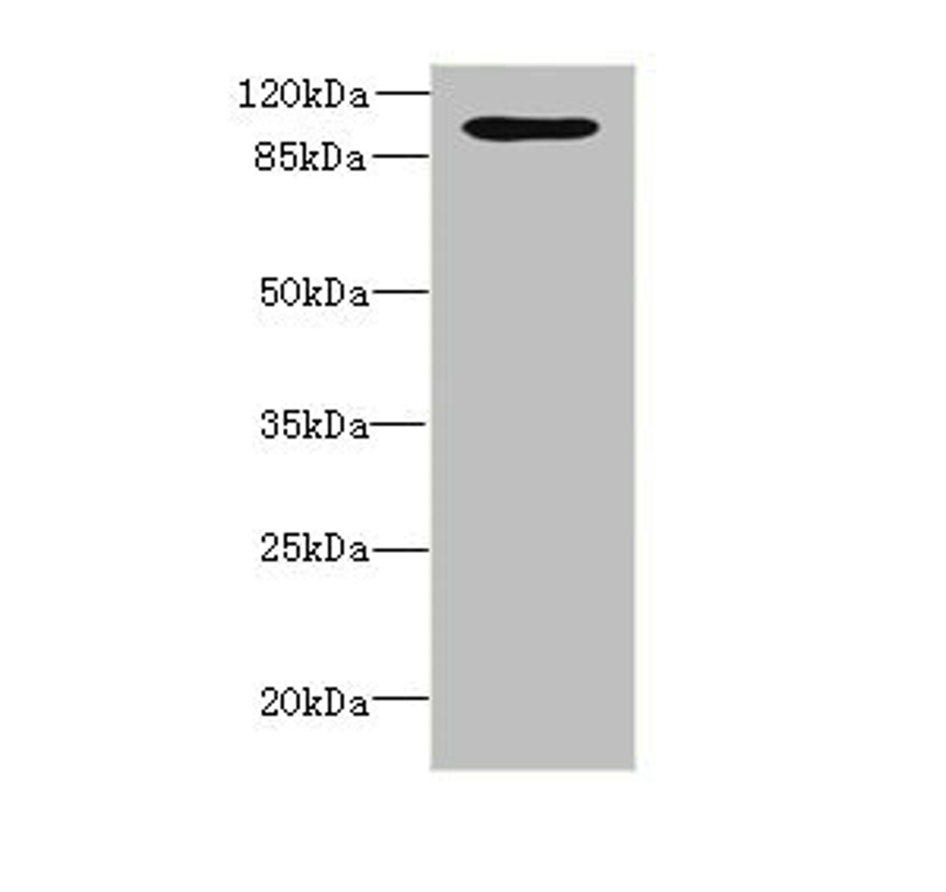 Western blot. All lanes: OPHN1 antibody at 1.87ug/ml + A549 whole cell lysate. Secondary. Goat polyclonal to rabbit IgG at 1/10000 dilution. Predicted band size: 92, 37 kDa. Observed band size: 92 kDa. 