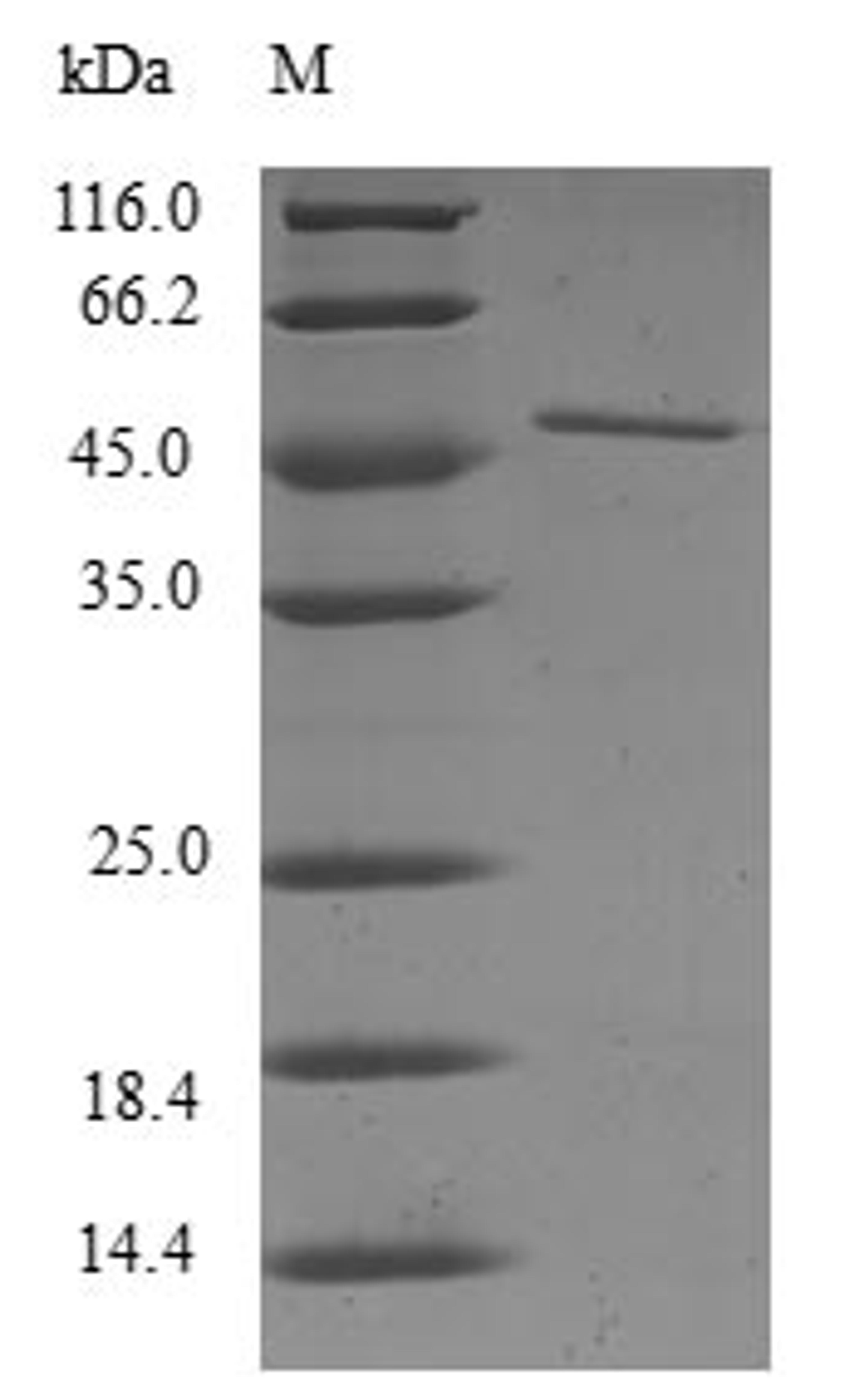 (Tris-Glycine gel) Discontinuous SDS-PAGE (reduced) with 5% enrichment gel and 15% separation gel.