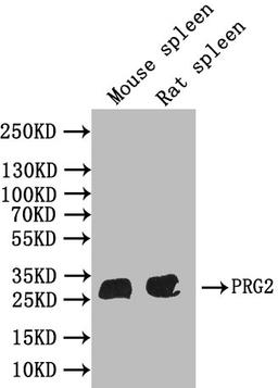 Western BlotPositive WB detected in: Mouse spleen tissue lysate,Rat spleen tissue lysateAll lanes: PRG2 antibody at 1:1000SecondaryGoat polyclonal to rabbit IgG at 1/50000 dilutionPredicted band size: 25, 28 kDaObserved band size: 28 kDa