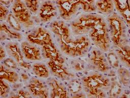 IHC image of CSB-PA014653LA11HU diluted at 1:200 and staining in paraffin-embedded human kidney tissue performed on a Leica BondTM system. After dewaxing and hydration, antigen retrieval was mediated by high pressure in a citrate buffer (pH 6.0). Section was blocked with 10% normal goat serum 30min at RT. Then primary antibody (1% BSA) was incubated at 4°C overnight. The primary is detected by a Goat anti-rabbit polymer IgG labeled by HRP and visualized using 0.05% DAB.