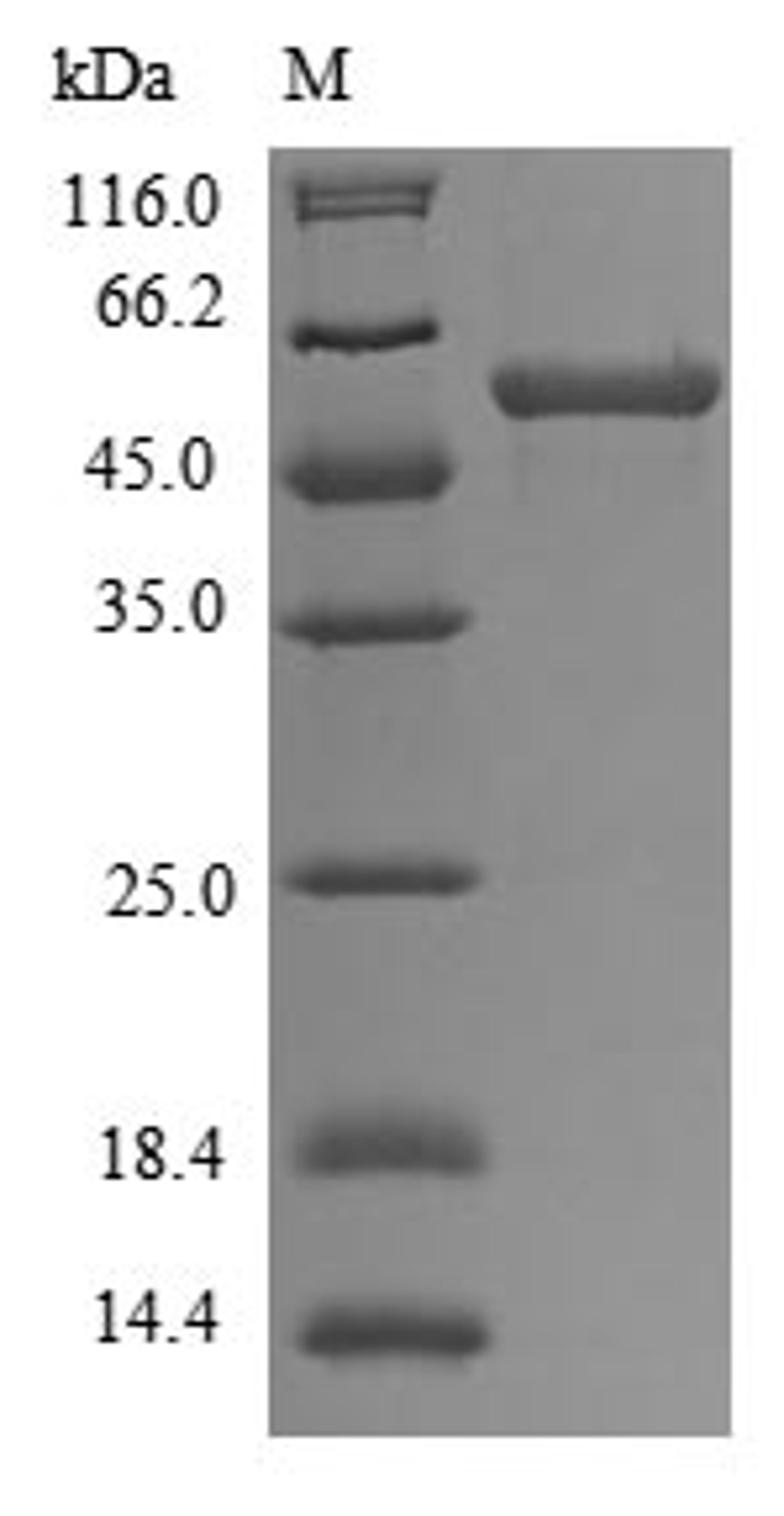 (Tris-Glycine gel) Discontinuous SDS-PAGE (reduced) with 5% enrichment gel and 15% separation gel.
