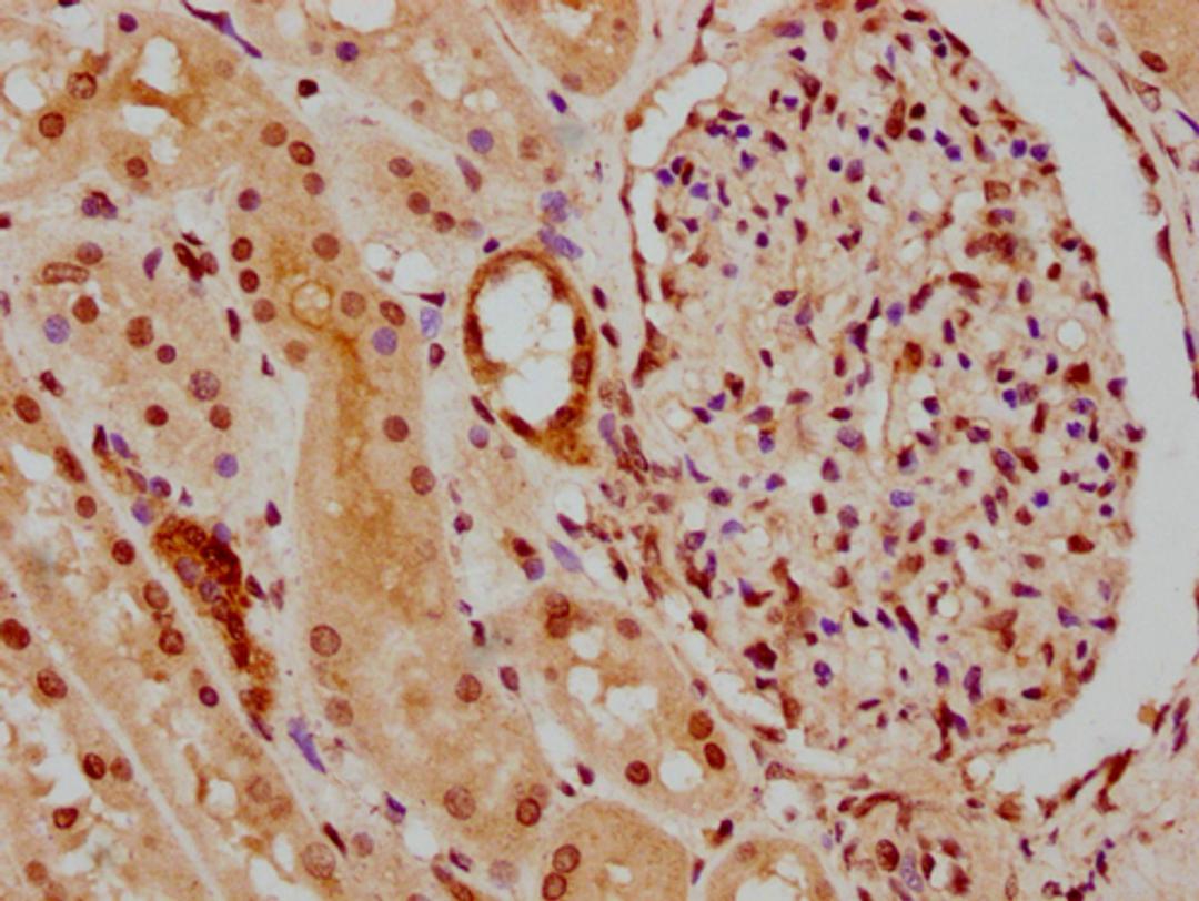 IHC image of CSB-PA010418PA45nphHU diluted at 1:30 and staining in paraffin-embedded human kidney tissue performed on a Leica BondTM system. After dewaxing and hydration, antigen retrieval was mediated by high pressure in a citrate buffer (pH 6.0). Section was blocked with 10% normal goat serum 30min at RT. Then primary antibody (1% BSA) was incubated at 4°C overnight. The primary is detected by a biotinylated secondary antibody and visualized using an HRP conjugated SP system.