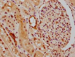 IHC image of CSB-PA010418PA45nphHU diluted at 1:30 and staining in paraffin-embedded human kidney tissue performed on a Leica BondTM system. After dewaxing and hydration, antigen retrieval was mediated by high pressure in a citrate buffer (pH 6.0). Section was blocked with 10% normal goat serum 30min at RT. Then primary antibody (1% BSA) was incubated at 4°C overnight. The primary is detected by a biotinylated secondary antibody and visualized using an HRP conjugated SP system.