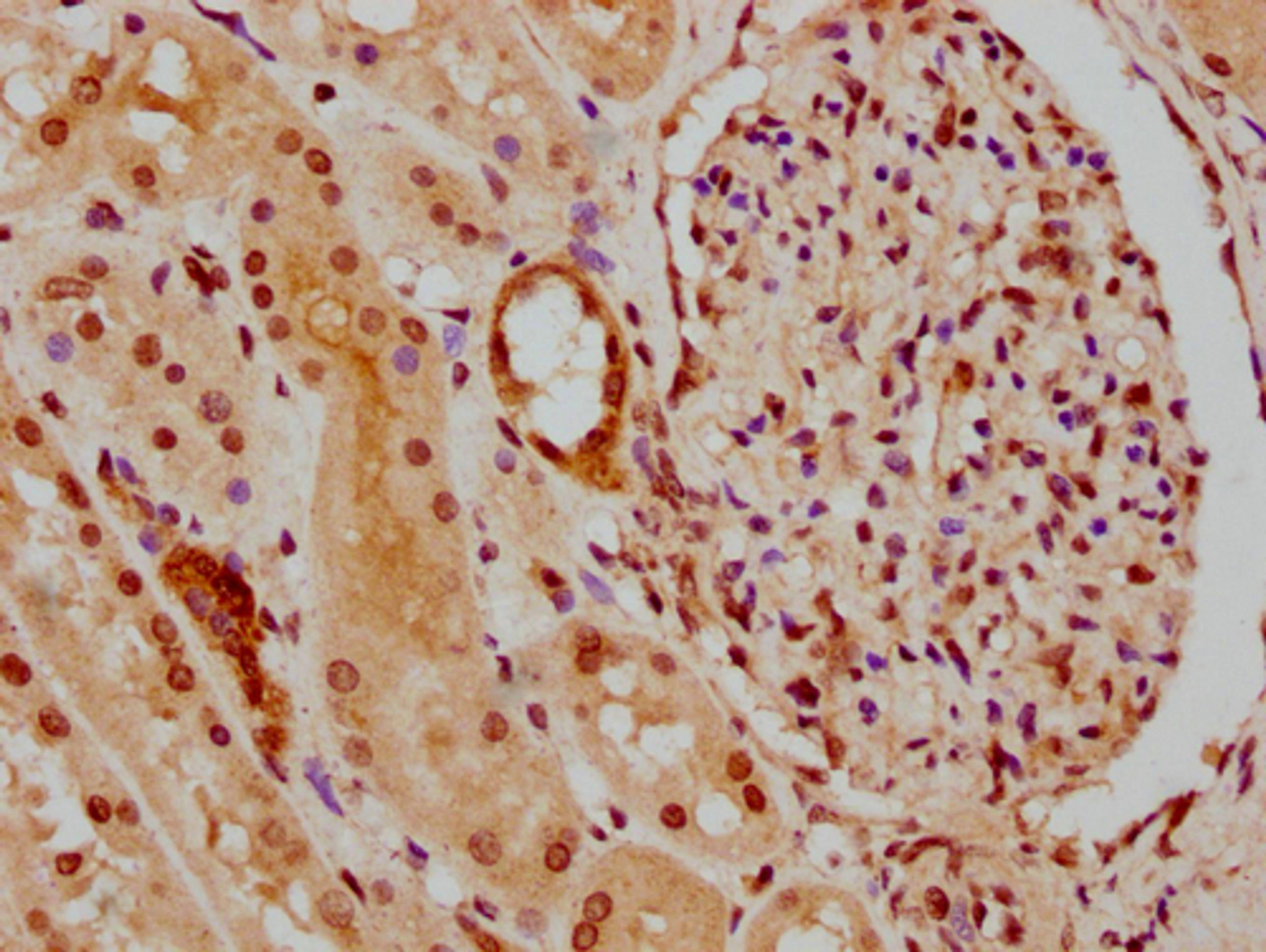 IHC image of CSB-PA010418PA45nphHU diluted at 1:30 and staining in paraffin-embedded human kidney tissue performed on a Leica BondTM system. After dewaxing and hydration, antigen retrieval was mediated by high pressure in a citrate buffer (pH 6.0). Section was blocked with 10% normal goat serum 30min at RT. Then primary antibody (1% BSA) was incubated at 4°C overnight. The primary is detected by a biotinylated secondary antibody and visualized using an HRP conjugated SP system.
