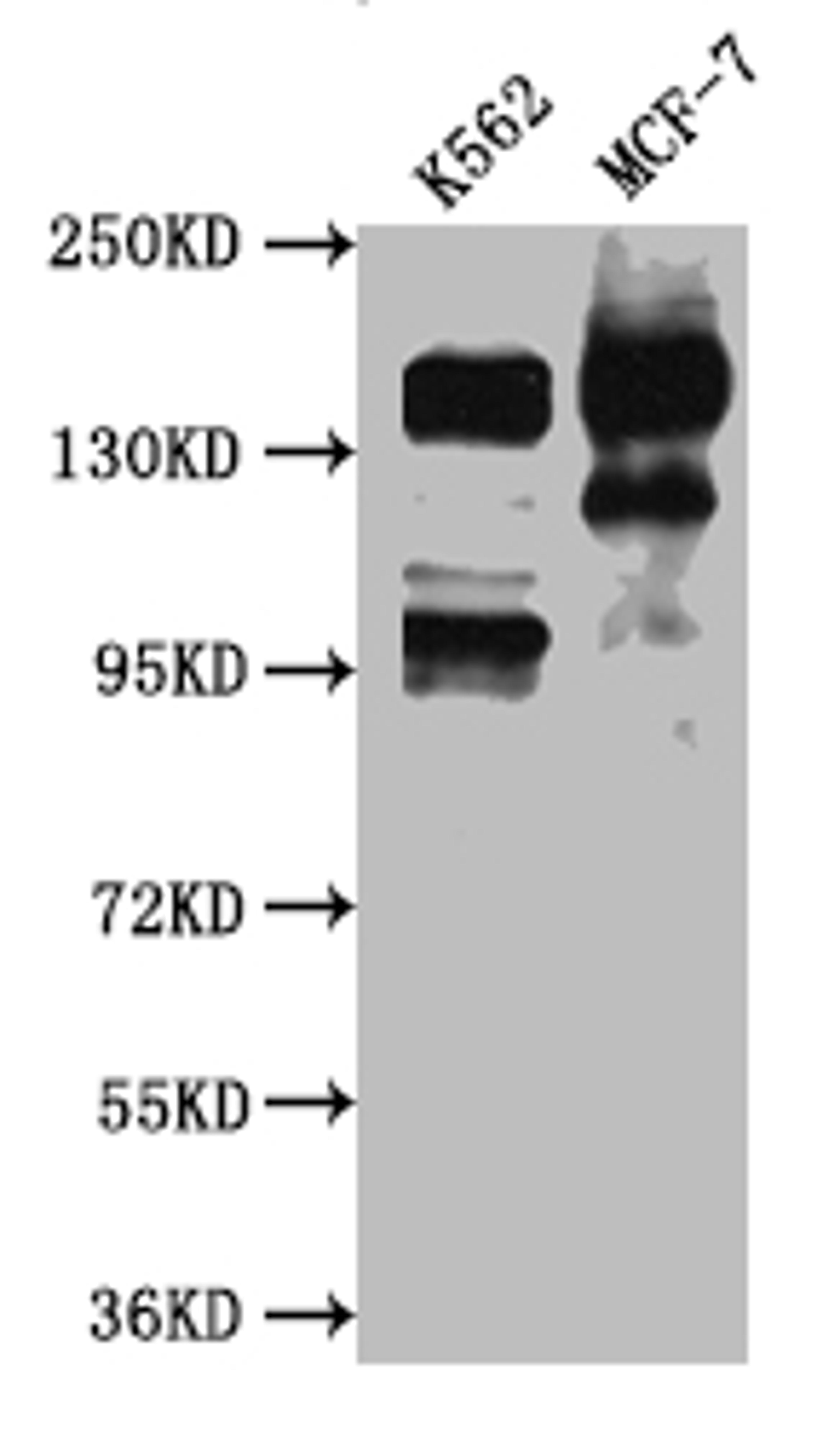 Western Blot. Positive WB detected in: K562 whole cell lysate, MCF-7 whole cell lysate. All lanes: mSin3A antibody at 1:1000. Secondary. Goat polyclonal to rabbit IgG at 1/50000 dilution. Predicted band size: 146 kDa. Observed band size: 146 kDa. 