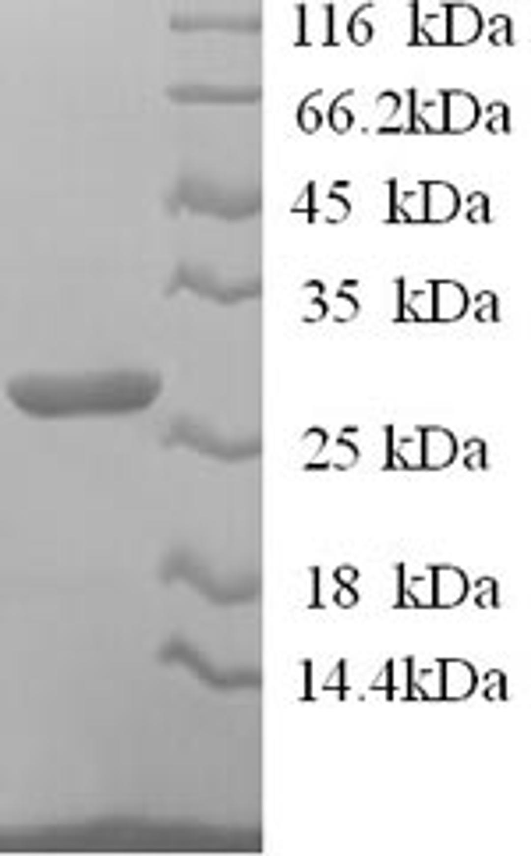 (Tris-Glycine gel) Discontinuous SDS-PAGE (reduced) with 5% enrichment gel and 15% separation gel.