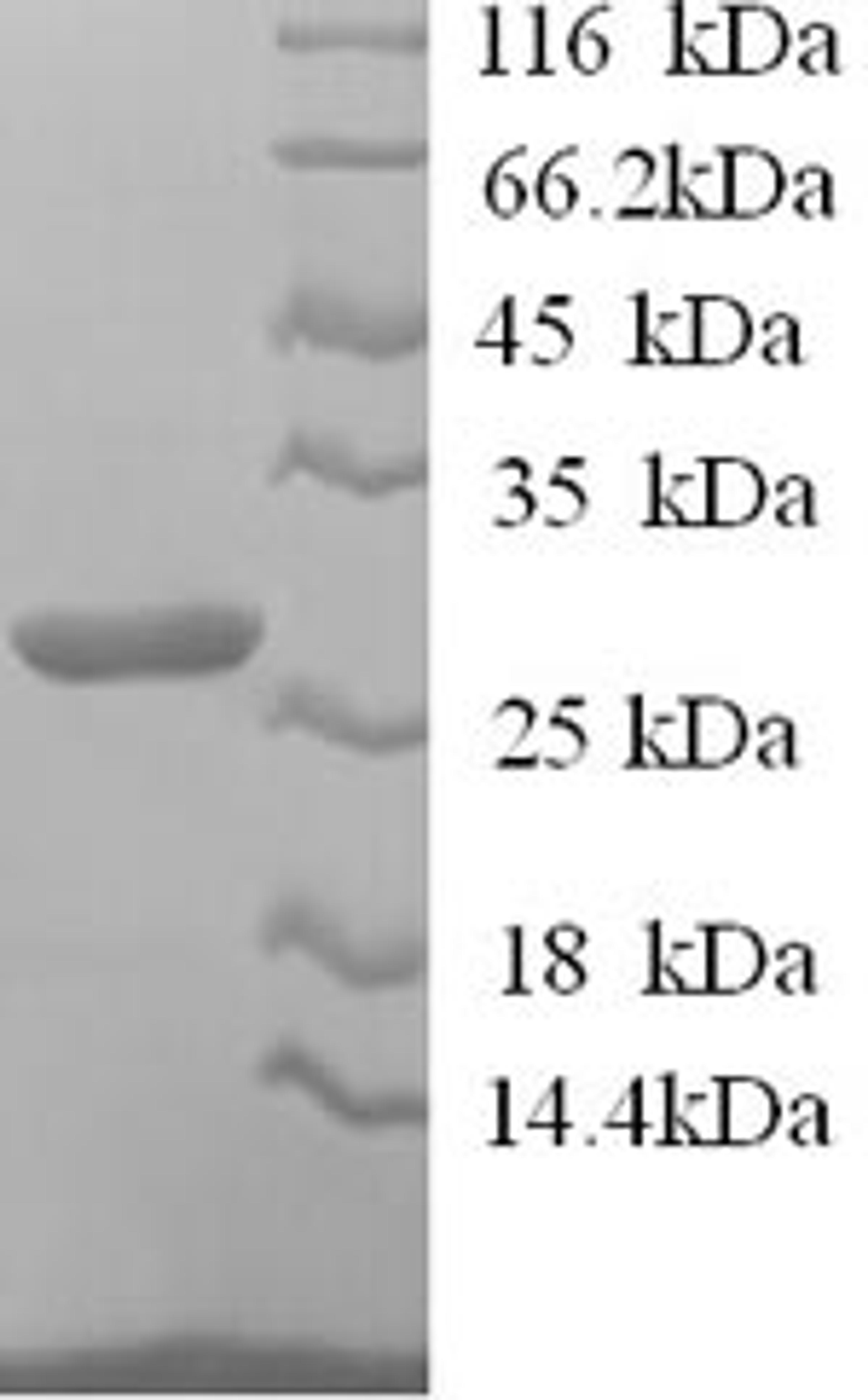 (Tris-Glycine gel) Discontinuous SDS-PAGE (reduced) with 5% enrichment gel and 15% separation gel.