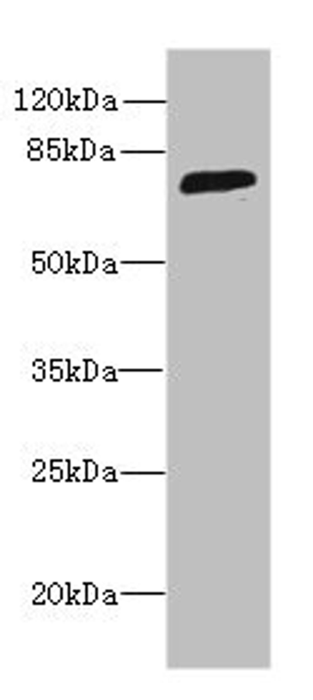 Western blot. All lanes: SORBS3 antibody at 8µg/ml + HepG2 whole cell lysate. Secondary. Goat polyclonal to rabbit IgG at 1/10000 dilution. Predicted band size: 76, 37 kDa. Observed band size: 76 kDa