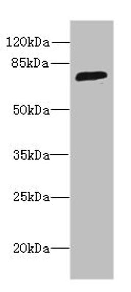 Western blot. All lanes: SORBS3 antibody at 8µg/ml + HepG2 whole cell lysate. Secondary. Goat polyclonal to rabbit IgG at 1/10000 dilution. Predicted band size: 76, 37 kDa. Observed band size: 76 kDa