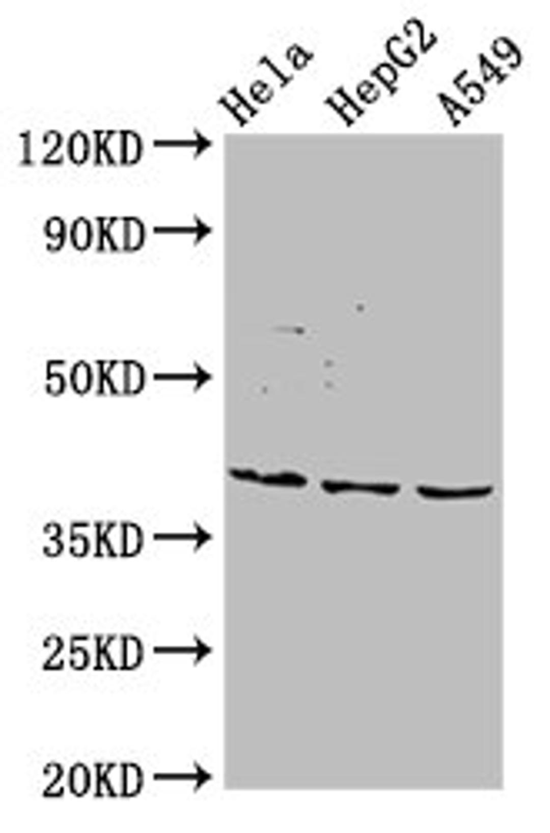 Western Blot. Positive WB detected in: Hela whole cell lysate, HepG2 whole cell lysate, A549 whole cell lysate. All lanes: NANS antibody at 5.5ug/ml. Secondary. Goat polyclonal to rabbit IgG at 1/50000 dilution. Predicted band size: 41 kDa. Observed band size: 41 kDa. 