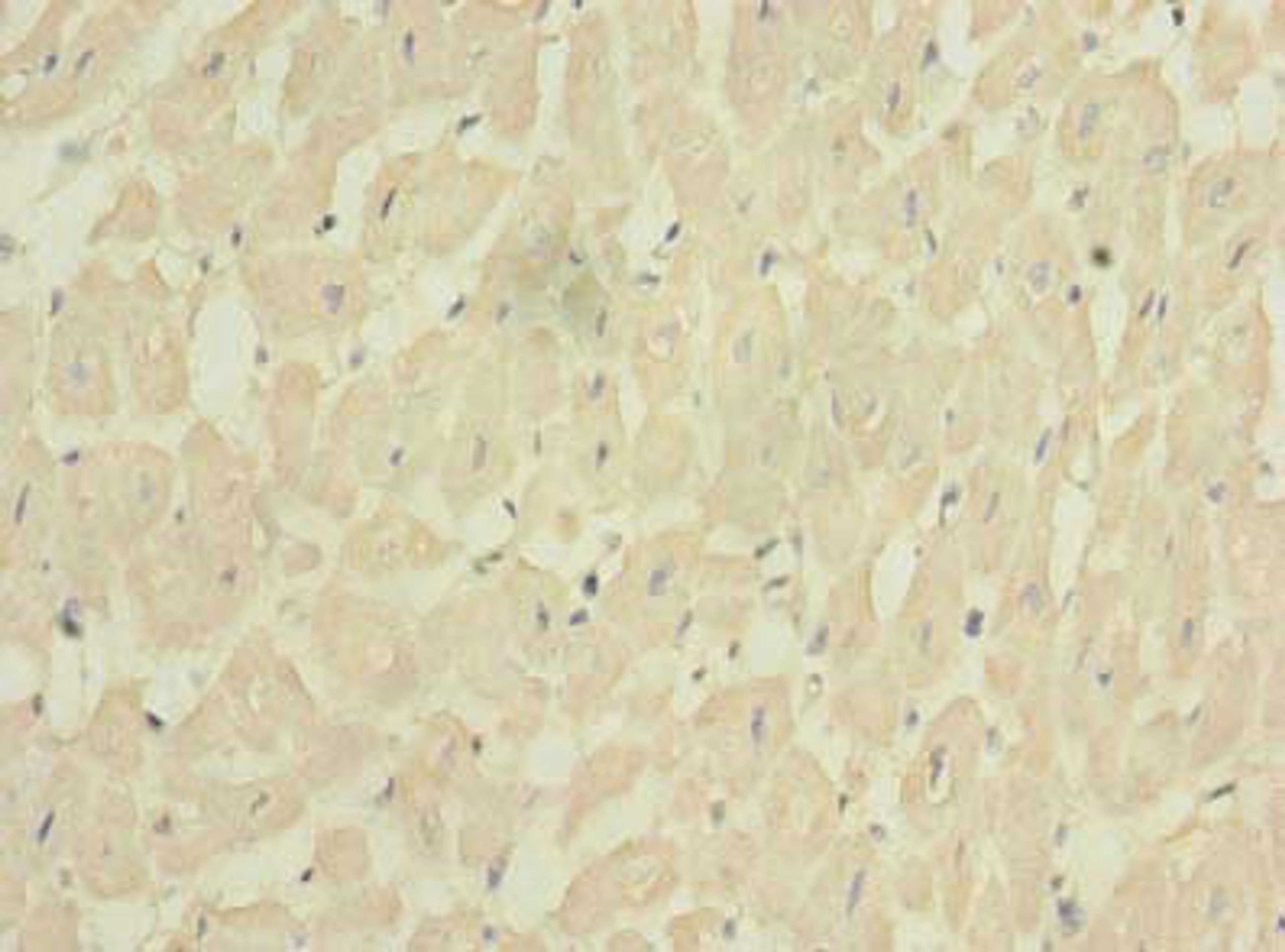 Immunohistochemistry of paraffin-embedded human heart tissue using CSB-PA009097LA01HU at dilution of 1:100