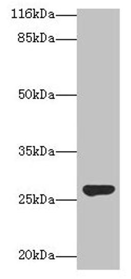 Western blot. All lanes: IZUMO4 antibody at 2µg/ml + Rat gonadal tissue. Secondary. Goat polyclonal to rabbit IgG at 1/10000 dilution. Predicted band size: 27, 25, 18, 19 kDa. Observed band size: 27 kDa