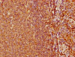 IHC image of CSB-PA617999LA01HU diluted at 1:500 and staining in paraffin-embedded human tonsil tissue performed on a Leica BondTM system. After dewaxing and hydration, antigen retrieval was mediated by high pressure in a citrate buffer (pH 6.0). Section was blocked with 10% normal goat serum 30min at RT. Then primary antibody (1% BSA) was incubated at 4°C overnight. The primary is detected by a biotinylated secondary antibody and visualized using an HRP conjugated SP system.