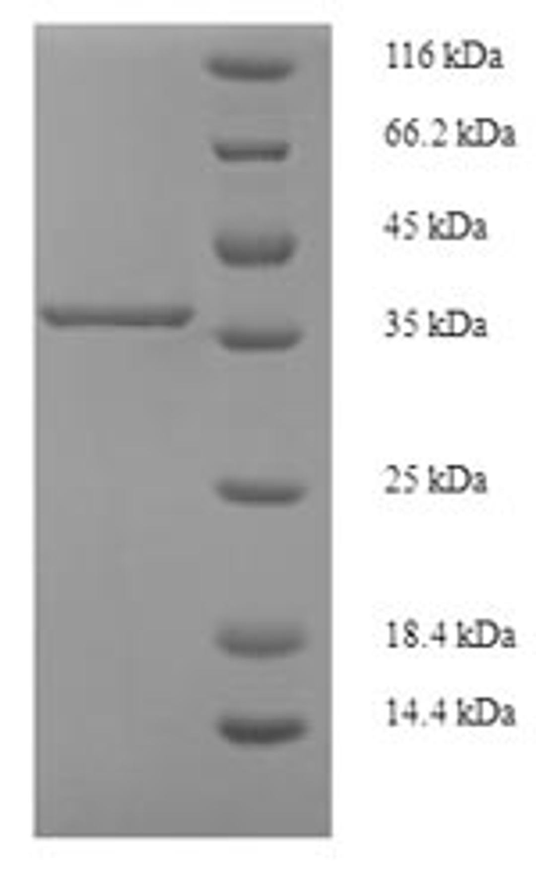 (Tris-Glycine gel) Discontinuous SDS-PAGE (reduced) with 5% enrichment gel and 15% separation gel.
