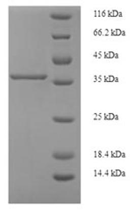 (Tris-Glycine gel) Discontinuous SDS-PAGE (reduced) with 5% enrichment gel and 15% separation gel.